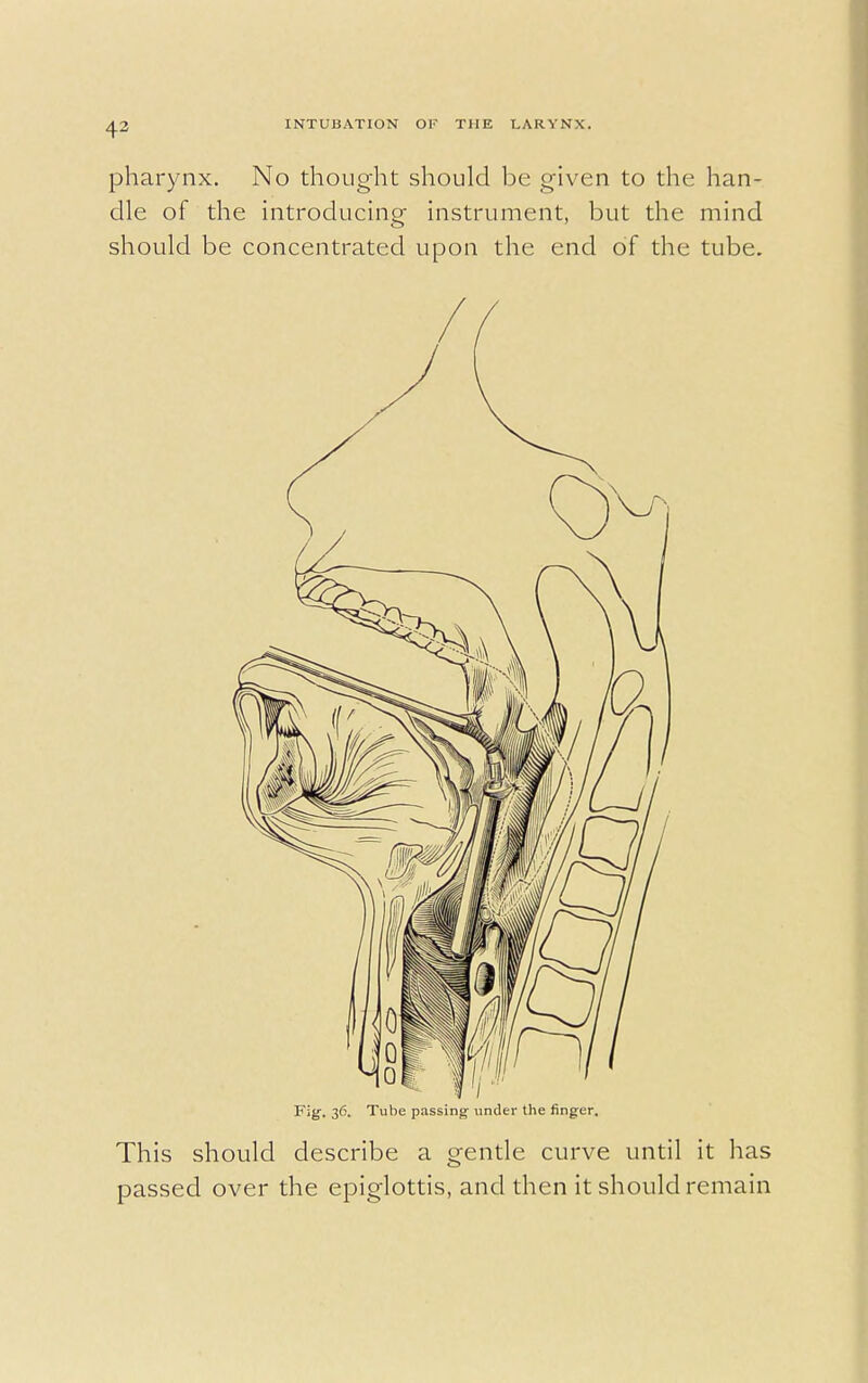 pharynx. No thought should be given to the han- dle of the introducing instrument, but the mind should be concentrated upon the end of the tube. Fig. 36. Tube passing under the finger. This should describe a gentle curve until it has passed over the epiglottis, and then it should remain