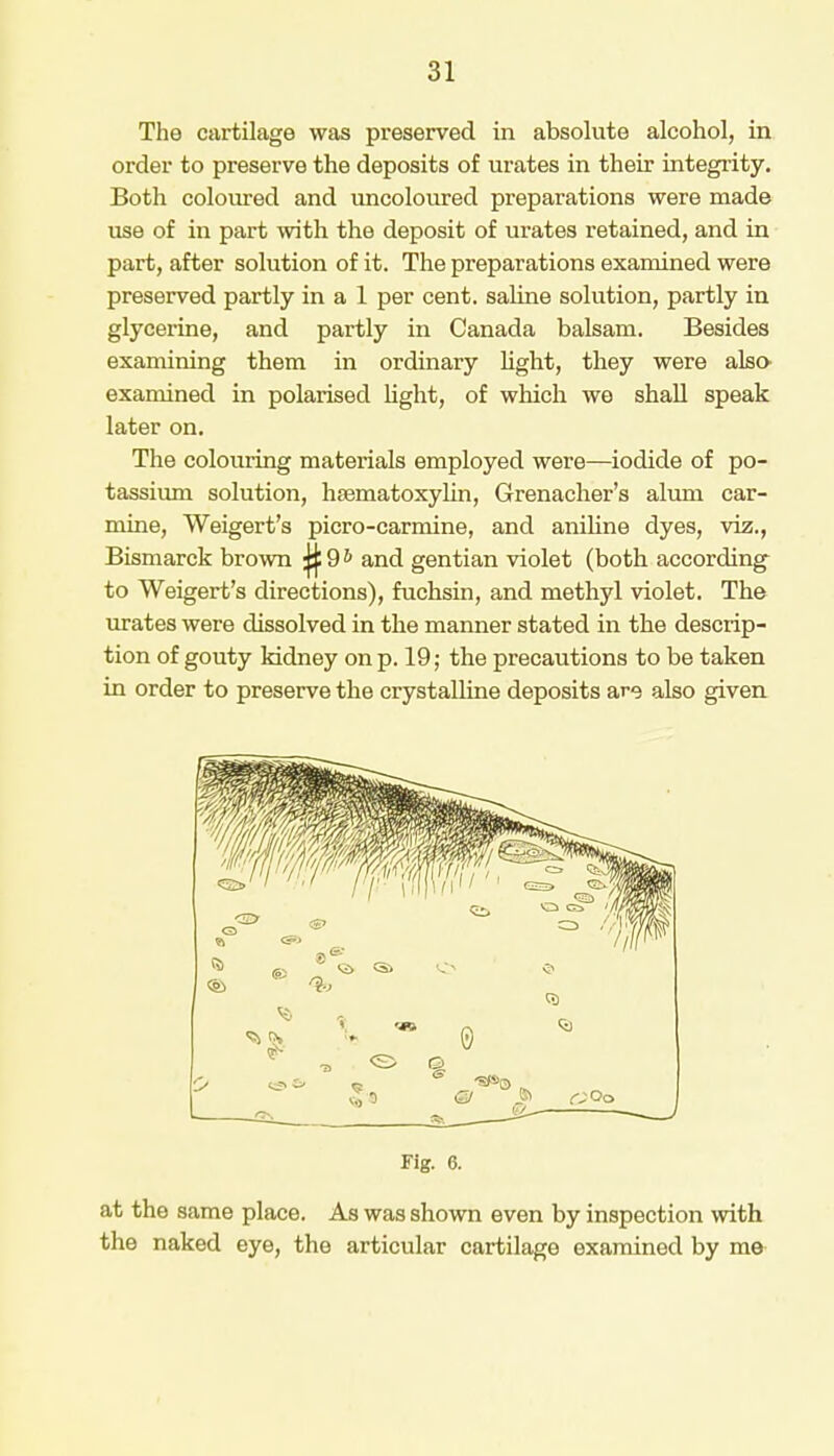 The cartilage was preserved in absolute alcohol, in order to preserve the deposits of urates in their integrity. Both coloured and uncoloured preparations were made use of in part with the deposit of urates retained, and in part, after solution of it. The preparations examined were preserved partly in a 1 per cent, saline solution, partly in glycerine, and partly in Canada balsam. Besides examining them in ordinary light, they were also* examined in polarised light, of which we shall speak later on. The colouring materials employed were—iodide of po- tassium solution, hsematoxylin, Grenacher's alum car- mine, Weigert's picro-carmine, and aniline dyes, viz., Bismarck brown Q 9 & and gentian violet (both according to Weigert's directions), fuchsin, and methyl violet. The urates were dissolved in the manner stated in the descrip- tion of gouty kidney on p. 19; the precautions to be taken in order to preserve the crystalline deposits are also given Fig. 6. at the same place. As was shown even by inspection with the naked eye, the articular cartilage examined by me
