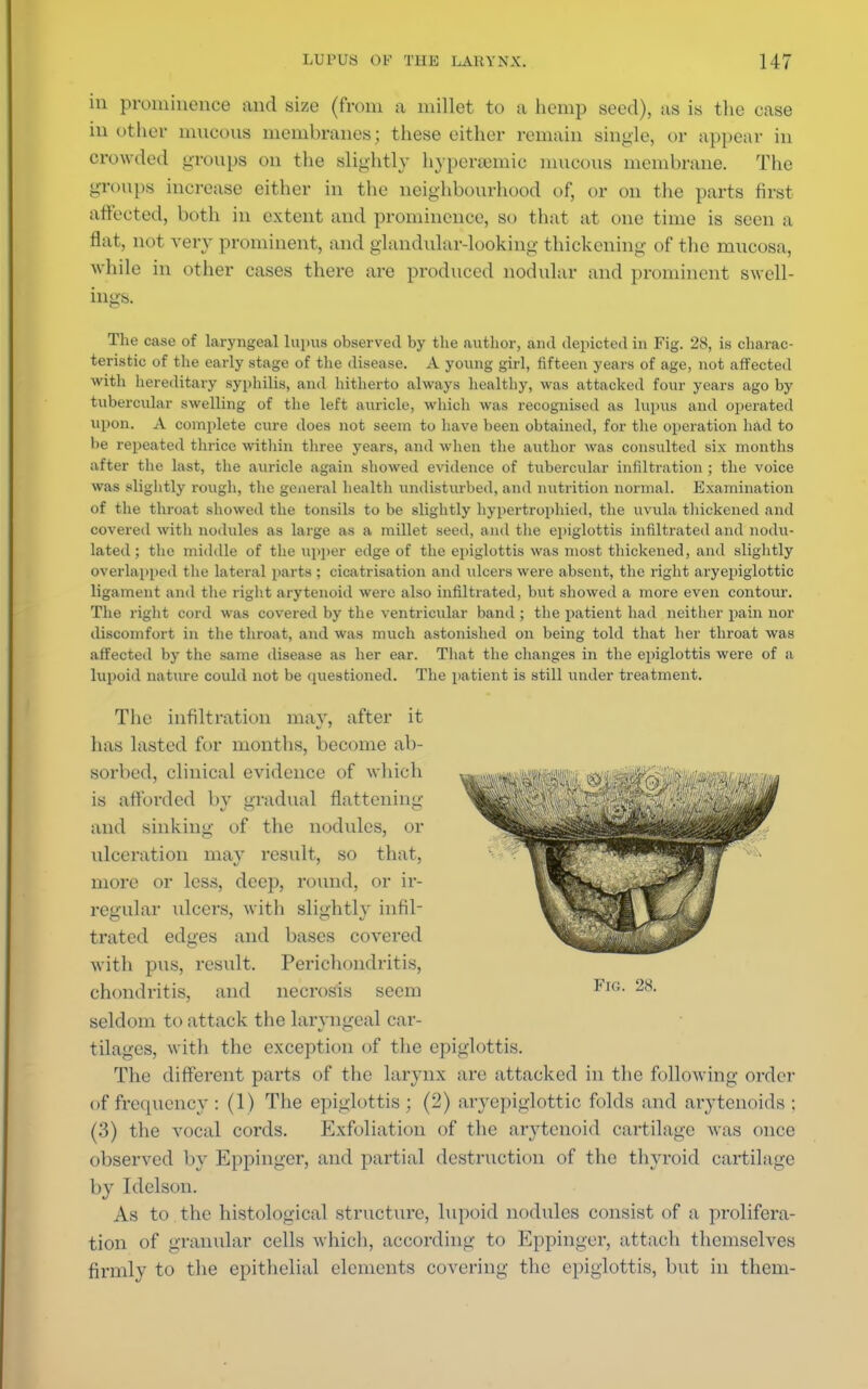 in prominence and size (from a millet to a hemp seed), us is the case in other mucous membranes; these either remain single, or appear in crowded groups on the slightly hyperamiic mucous membrane. The groups increase either in the neighbourhood of, or on the parts first affected, both in extent and prominence, so that at one time is seen a flat, not very prominent, and gland\ilar-looking thickening of the mucosa, while in other cases there are produced nodular and prominent swell- ings. The case of laryngeal lupus observed by the author, and depicted in Fig. 28, is charac- teristic of the early stage of the disease. A young girl, fifteen years of age, not affected with hereditary syphilis, and hitherto always healthy, was attacked four years ago by tubercular swelling of the left auricle, which was recognised as lupus and operated upon. A complete cure does not seem to have been obtained, for the operation had to be repeated thrice within three years, and when the author was consulted six months after the last, the auricle again showed evidence of tubercular infiltration ; the voice was slightly rough, the general health undisturbed, and nutrition normal. Examination of the throat showed the tonsils to be slightly hypertrophied, the uvula thickened and covered with nodules as large as a millet seed, and the epiglottis infiltrated and nodu- lated; the middle of the upper edge of the epiglottis was most thickened, and slightly overlapped the lateral parts ; cicatrisation and idcers were absent, the right aryepiglottic ligament and the right arytenoid were also infiltrated, but showed a more even contoiir. The right cord was covered by the ventricular band ; the patient had neither pain nor discomfort in the throat, and was much astonished on being told that her throat was affected by the same disease as her ear. That the changes in the epiglottis were of a lupoid nature could not be questioned. The patient is still under treatment. The infiltration may, after it has lasted for months, become ab- sorbed, clinical evidence of which is afforded by gradual flattening and sinking of the nodules, or ulceration may result, so that, more or less, deep, round, or ir- regular ulcers, with slightly infil- trated edges and bases covered with pus, result. Perichondritis, chondritis, and necrosis seem seldom to attack the laryngeal car- tilages, with the exception of the epiglottis. The different parts of the larynx are at tacked in the following order of frequency : (1) The epiglottis ; (2) aryepiglottic folds and arytenoids ; (3) the vocal cords. Exfoliation of the arytenoid cartilage was once observed by Eppinger, and partial destruction of the thyroid cartilage by Idelson. As to the histological structure, lupoid nodules consist of a prolifera- tion of granular cells which, according to Eppinger, attach themselves firmlv to the epithelial elements covering the epiglottis, but in them-