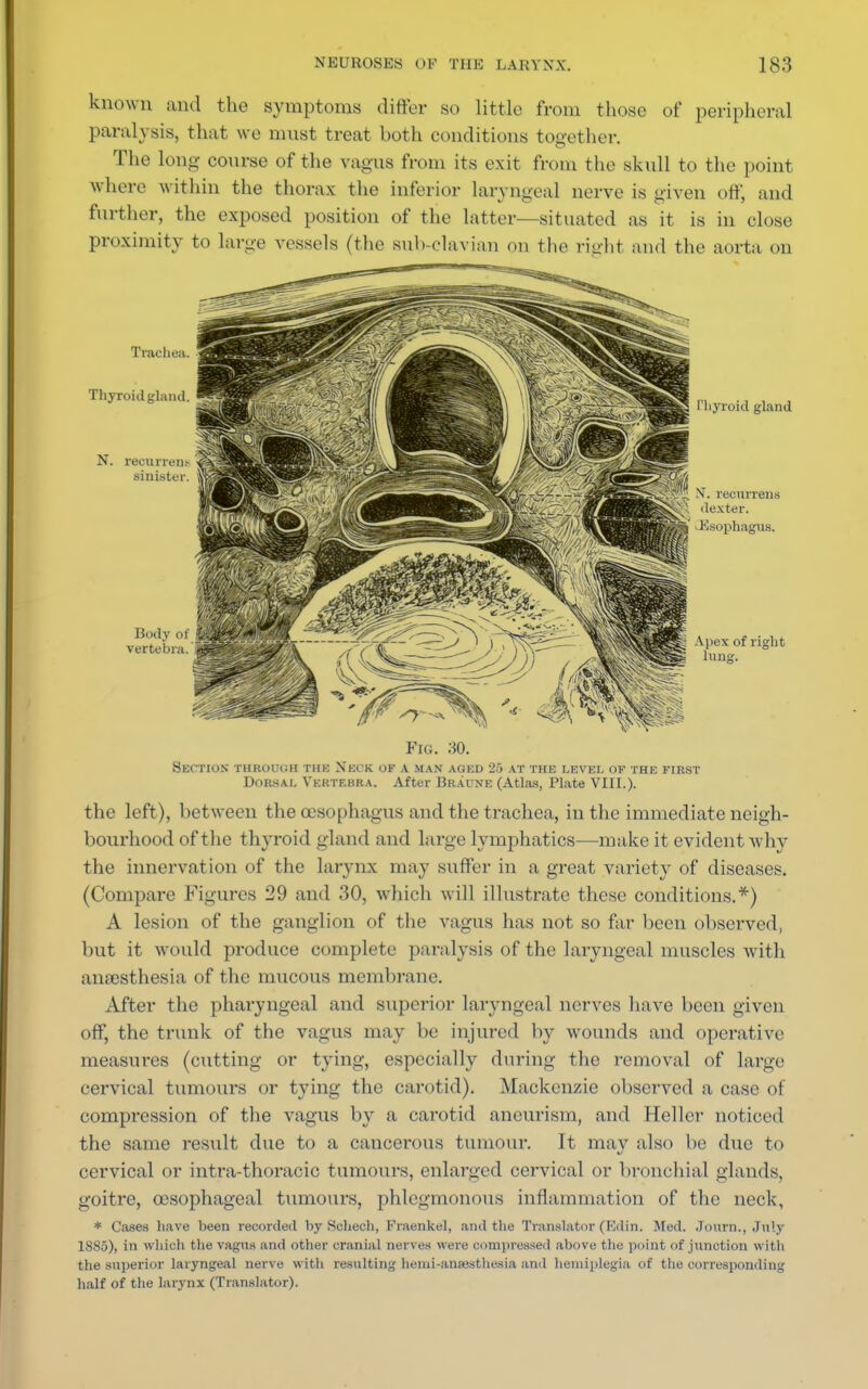 known and the symptoms differ so little from those of peripheral paralysis, that we must treat both conditions together. The long course of the vagus from its exit from the skull to the point where within the thorax the inferior laryngeal nerve is given off, and further, the exposed position of the latter—situated as it is in close proximity to large vessels (the suh-clavian on the right and the aorta on Fig. 30. Section through thk Neck of a man aged 20 at the level ok the first Dorsal Vertebra. After Braune (Atlas, Plate VIII.). the left), between the cesophagus and the trachea, in the immediate neigh- bourhood of the thyroid gland and large lymphatics—make it evident Avhy the innervation of the larynx may suffer in a great variety of diseases. (Compare Figures 29 and 30, which will illustrate these conditions.*) A lesion of the ganglion of the vagus has not so far been observed, but it would produce complete paralysis of the laryngeal muscles with anesthesia of the mucous membrane. After the pharyngeal and superior laryngeal nerves have been given off, the trunk of the vagus may be injured by wounds and operative measures (cutting or tying, especially during the removal of large cervical tumours or tying the carotid). Mackenzie observed a case of compression of the vagus by a carotid aneurism, and Heller noticed the same result due to a cancerous tumour. It may also be due to cervical or intra-thoracic tumours, enlarged cervical or bronchial glands, goitre, oesophageal tumours, phlegmonous inflammation of the neck, * Cases have been recorded by Scheeh, Fraenkel, and the Translator (Edin. Med. Journ., July 1885), in which the vagus and other cranial nerves irere compressed above the point of junction with the superior laryngeal nerve with resulting heini-ansesthesia and hemiplegia of the corresponding half of the larynx (Translator).