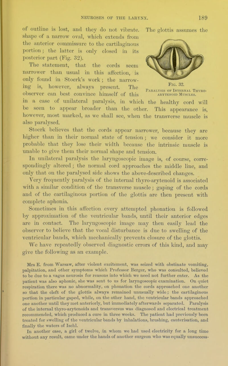 of outline is lost, and they do not vibrate. The glottis assumes the shape of a narrow oval, which extends from the anterior oommissure to the cartilaginous portion; the latter is only closed in its posterior part (Fig. 32). The statement, that the cords seem narrower than usual in this affection, is only found in Stoerk's work; the narrow- ing is, however, always present. The . .... Paralysis of Internal Thyro- observer can best convince himself of this arytenoid Muscles. in a case of unilateral paralysis, in which the healthy cord will he seen to appear broader than the other. This appearance is, however, most marked, as we shall see, when the transverse muscle is also paralysed. Stoerk believes that the cords appear narrower, because they are higher than in their normal state of tension; we consider it more probable that they lose their width because the intrinsic muscle is unable to give them their normal shape and tension. In unilateral paralysis the laryngoscopic image is, of course, corre- spondingly altered ; the normal cord approaches the middle line, and only that on the paralysed side shows the above-described changes. Very frequently paralysis of the internal thyro-arytenoid is associated with a similar condition of the transverse muscle; gaping of the cords and of the cartilaginous portion of the glottis are then present with complete aphonia. Sometimes in this affection every attempted phonation is followed by approximation of the ventricular bands, until their anterior edges are in contact. The laryngoscopic image may then easily lead the observer to believe that the vocal disturbance is due to swelling of the ventricular bands, which mechanically prevents closure of the glottis. We have repeatedly observed diagnostic errors of this kind, and may give the following as an example. Mrs H. from Warsaw, after violent excitement, was seized with obstinate vomiting, palpitation, and other symptoms which Professor Berger, who was consulted, believed to be due to a vagus neurosis for reasons into which we need not further enter. As the patient was also aphonic, she was sent to us for laryngoscopic examination. On quiet respiration there was no abnormality, on phonation the cords approached one another so that the cleft of the glottis always remained unusually wide; the cartilaginous portion in particular gaped, while, on the other hand, the ventricular bands approached one another until they met anteriorly, but immediately afterwards separated. Paralysis of the internal thyro-arytenoids and transversus was diagnosed and electrical treatment recommended, which produced a cure in three weeks. The patient had previously been treated for swelling of the ventricular bands by inhalations, brushing, cauterisation, and finally the waters of Ischl. In another case, a girl of twelve, in whom we had used electricity for a long time without any result, came under the hands of another surgeon who was equally unsuccess-
