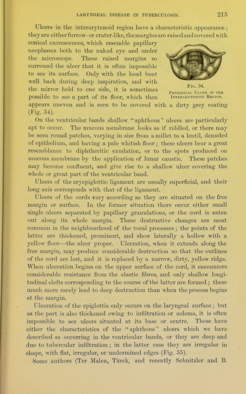 Ulcers in the interarytenoid region have a characteristic appearance ; they are either furrow- or crater-like, the margins are raised and covered with conical excrescences, which resemble papillary neoplasms both to the naked eye and under the microscope. These raised margins so Surround the ulcer that it is often impossible to see its surface. Onlv with the head bent well buck during dee}) inspiration, and with the mirror held to one side, it is sometimes Phthisical Ulceb in the possible to see a part of its floor, which then inti.kaumi.noid Rjkjiok, appears uneven and is seen to be covered with a dirty grey coating (Fig. 34). On the ventricular bands shallow aphthous ulcers are particularly apt to occur. The mucous membrane looks as if riddled, or there may be seen round patches, varying in size from a millet to a lentil, denuded of epithelium, and having a pale whitish floor ; these ulcers bear a great resemblance to diphtheritic exudation, or to the spots produced on mucous membrane by the application of lunar caustic. These patches may become confluent, and give rise to a shallow ulcer covering the whole or great part of the ventricular band. Ulcers of the aryepiglottic ligament are usually superficial, and their long axis corresponds with that of the ligament, Ulcers of the cords vary according as they are situated on the free margin or surface. In the former situation there occur either small single ulcers separated by papillary graimlations, or the cord is eaten out along its whole margin. These destructive changes are most common in the neighbourhood of the vocal processes; the points of the latter are thickened, prominent, and show laterally a hollow with a yellow floor—the ulcer proper. Ulceration, when it extends along the free margin, may produce considerable destruction so that the outlines of the cord are lost, and it is replaced by a narrow, dirty, yellow ridge. When ulceration begins on the upper surface of the cord, it encounters considerable resistance from the elastic fibres, and only shallow longi- tudinal clefts corresponding to the course of the latter are formed; these much more rarely lead to deep destruction than when the process begins at the margin. Ulceration of the epiglottis only occurs on the laryngeal surface; but as the part is also thickened owing to infiltration or oedema, it is often impossible to see ulcers situated at its base or centre. These have either the characteristics of the  aphthous ulcers which we have described as occurring in the ventricular bands, or they are deep and due to tubercular infiltration; in the latter case they are irregular in shape, with flat, irregular, or undermined edges (Fig. 35). Some authors (Ter Malen, Turck, and recently Schnitzler and B.