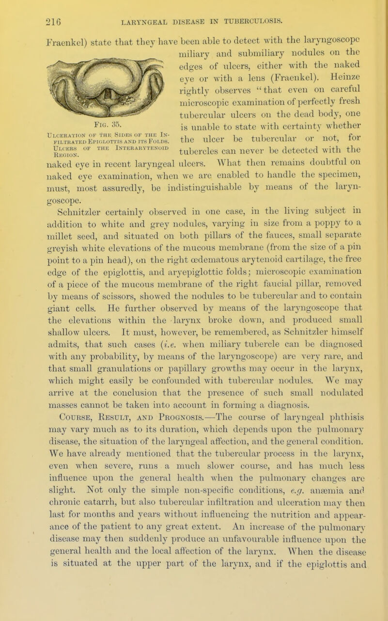 Fraenkel) state that they have been able to detect with the laryngoscope miliary and submiliary nodules on the edges of ulcers, either with the naked eye or with a lens (Fraenkel). Heinze rightly observes that even on careful microscopic examinat ion of perfectly fresh tubercular ulcers on the dead body, one is unable to state with certainty whether Ulceration OF thk Sides of the In- ., , i . i „_„,,i„,, f.~.v filtrated Epiglottis audits Folds, the ulcer be tubercular 01 not, toi Ulcers ok the Interarvteno.d ubercles can never be detected with the naked eye in recent laryngeal ulcers. What then remains doubtful on naked eye examination, when we are enabled to handle the specimen, must, most assuredly, be indistinguishable by means of the laryn- goscope. Schnitzler certainly observed in one case, in the living subject in addition to white and grey nodules, varying in size from a poppy to a millet seed, and situated on both pillars of the fauces, small separate greyish white elevations of the mucous membrane (from the size of a pin point to a pin head), on the right ocdematous arytenoid cartilage, the free edge of the epiglottis, and aryepiglottic folds; microscopic examination of a piece of the mucous membrane of the right faueial pillar, removed by means of scissors, showed the nodules to be tubercular and to contain giant cells. He further observed by means of the laryngoscope that the elevations within the larynx broke down, and produced small shallow ulcers. It must, however, be remembered, as Schnitzler himself admits, that such cases (i.e. when miliary tubercle can be diagnosed with any probability, by means of the laryngoscope) are very rare, and that small granulations or papillary growths may occur in the larynx, which might easily be confounded with tubercular nodules. We may arrive at the conclusion that the presence of such small nodulated masses cannot be taken into account in forming a diagnosis. Course, Result, and Prognosis.—The course of laryngeal phthisis may vary much as to its duration, which depends upon the pulmonary disease, the situation of the laryngeal affection, and the general condition. We have already mentioned that the tubercular process in the larynx, even when severe, runs a much slower course, and has much less influence upon the general health when the pulmonary changes are slight. Not only the simple non-specific conditions, e.g. ansemia and chronic catarrh, but also tubercular infiltration and ulceration may then last for months and years without influencing the nutrition and appear- ance of the patient to any great extent. An increase of the pulmonarv disease may then suddenly produce an unfavourable influence upon the general health and the local affection of the larynx. When the disease is situated at the upper part of the larynx, and if the epiglottis and