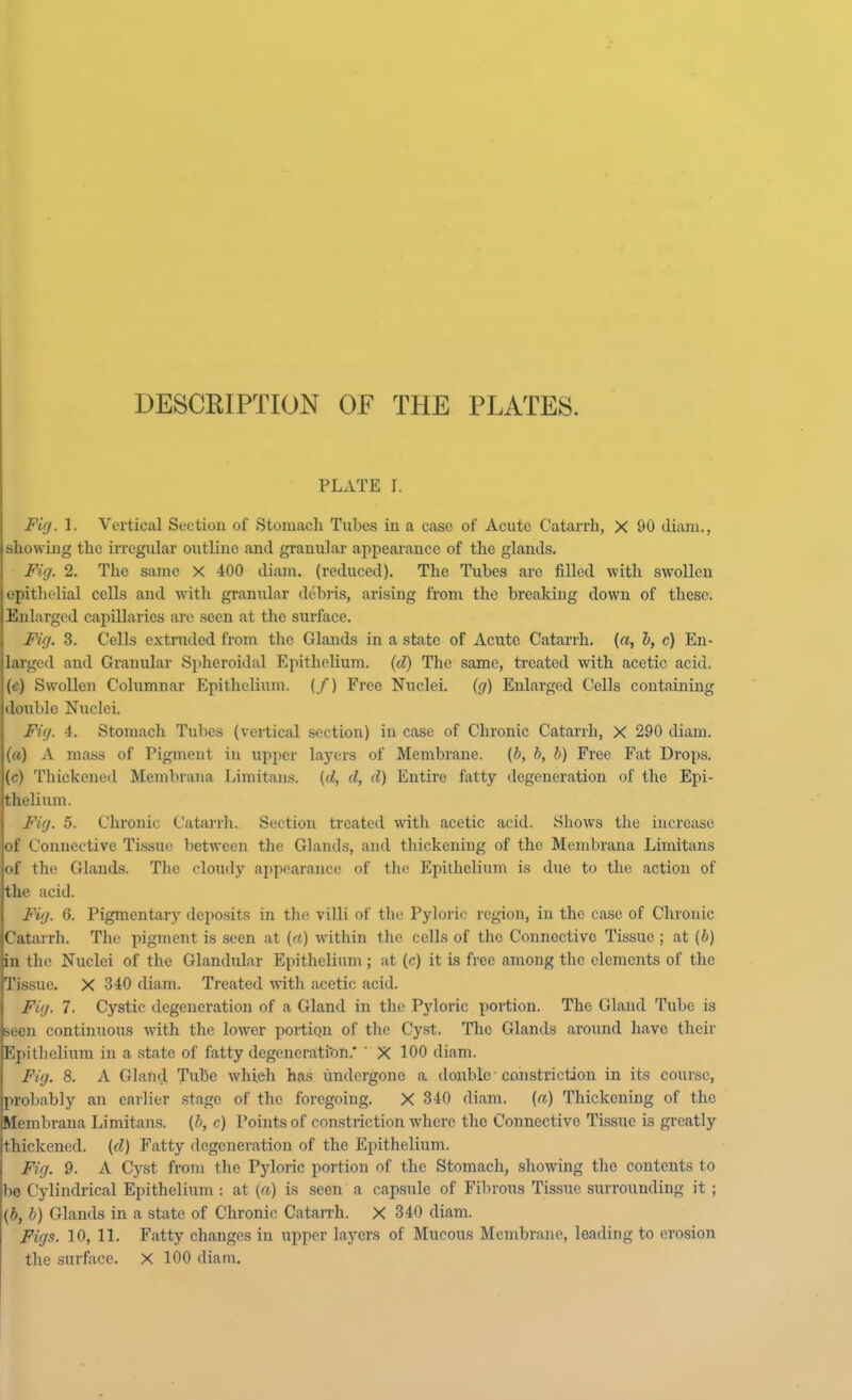 PLATE I. Fig. 1. Vertical Section of .Stomach Tubes in a case of Acute Catarrh, X 90 diam., showing the irregular outline and granular appearance of the glands. Fig. 2. The same X 400 diam. (reduced). The Tubes are filled with swollen epithelial cells and with granular debris, arising from the breaking down of these. Enlarged capillaries are seen at the surface. Fig. 3. Cells extruded from the Glands in a state of Acute Catarrh, (a, b, c) En- larged and Granular Spheroidal Epithelium, (d) The same, treated with acetic acid. (e) Swollen Columnar Epithelium. (/) Free Nuclei. (g) Enlarged Cells containing double Nuclei. Fig. 4. Stomach Tubes (vertical section) in case of Chronic Catarrh, X 290 diam. («) A mass of Pigment in upper layers of Membrane, {b, b, b) Free Fat Drops, (c) Thickened Meinbrana Limitans. (d, d, d) Entire fatty degeneration of the Epi- thelium. Fig. 5. Chronic Catarrh. Section treated with acetic acid. Shows the increase of Connective Tissue between the Glands, and thickening of the Membrana Limitans of the Glands. The cloudy appearance of the Epithelium is due to the action of the acid. Fig. 6. Pigmentary deposits in the villi of the Pyloric region, in the case of Chronic Catarrh. The pigment is seen at (a) within the cells of the Connective Tissue ; at (b) in the Nuclei of the Glandular Epithelium ; at (c) it is free among the elements of the Tissue. X 340 diam. Treated with acetic acid. Fig. 7. Cystic degeneration of a Gland in the Pyloric portion. The Gland Tube is seen continuous with the lower portion of the Cyst. The Glands around have their Epithelium in a state of fatty degenerati'on.' ' X 100 diam. Fig. 8. A Gland Tube whieh has undergone a double constriction in its course, probably an earlier stage of the foregoing. X 340 diam. (a) Thickening of the Membrana Limitans. (b, c) Points of constriction where the Connective Tissue is greatly thickened, (d) Fatty degeneration of the Epithelium. Fig. 9. A Cyst from the Pyloric portion of the Stomach, showing the contents to be Cylindrical Epithelium s at (a) is seen a capsule of Fibrous Tissue surrounding it ; {b, b) Glands in a state of Chronic Catarrh. X 340 diam. Figs. 10, 11. Fatty changes in upper layers of Mucous Membrane, leading to erosion