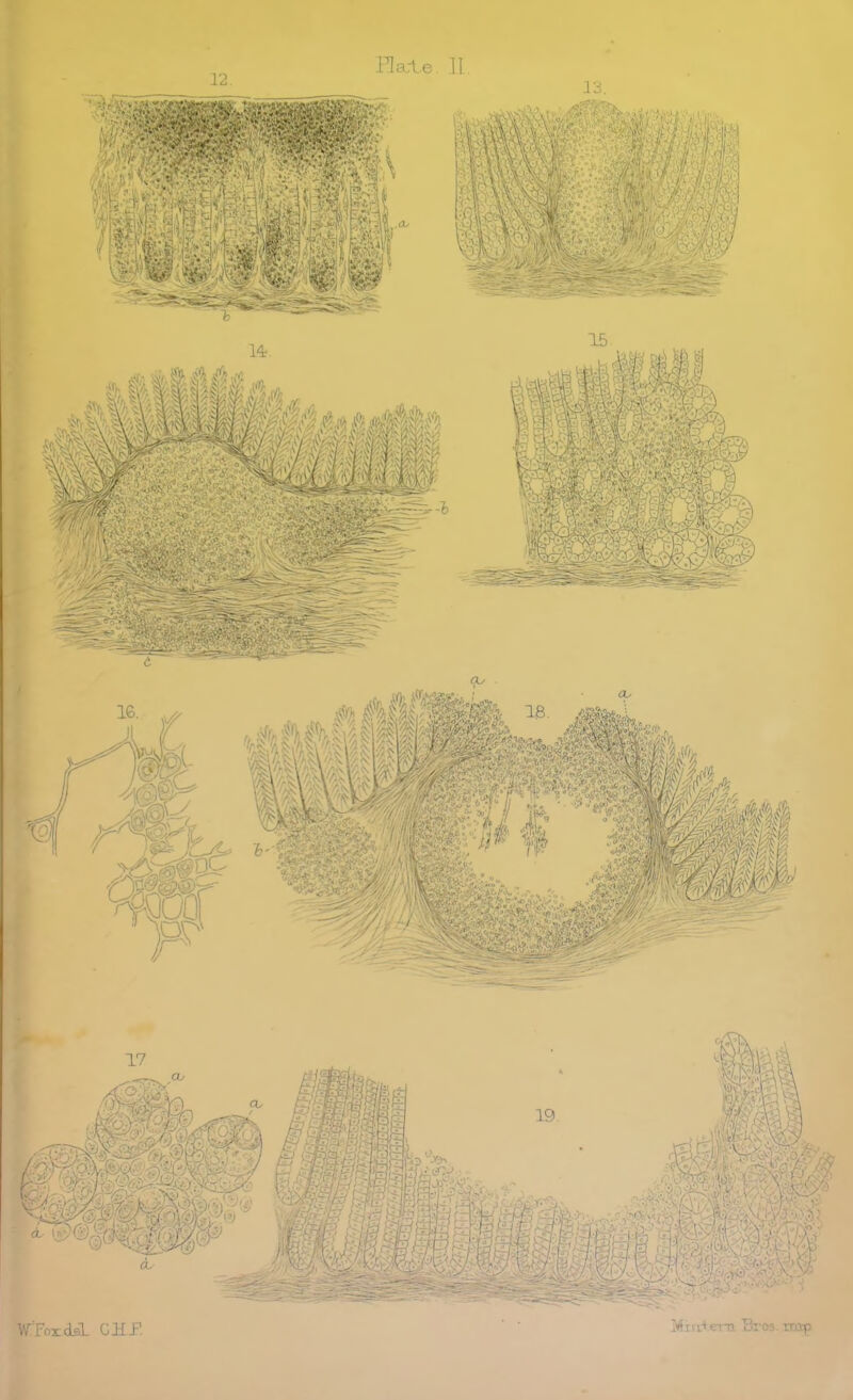 Hacte. 11 WTordiL CUP. Mux* era Bros, nap