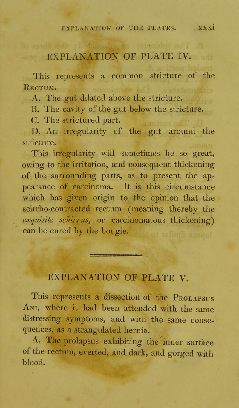 EXPLANATION OF PLATE IV. This represents a common stricture of the Rectum. A. The gut dilated above the stricture. B. The cavity of the gut below the stricture. C. The strictured part. D. An irregularity of the gut around the stricture. This irregularity will sometimes be so great, owing to the irritation, and consequent thickening of the surrounding parts, as to present the ap- pearance of carcinoma. It is this circumstance which has given origin to the opinion that the scirrho-contracted rectum (meaning thereby the exquisite schirrus, or carcinomatous thickening) can be cured by the bougie. EXPLANATION OF PLATE V. This represents a dissection of the Prolapsus Ani, where it had been attended with the same distressing symptoms, and with the same conse- quences, as a strangulated hernia. A. The prolapsus exhibiting the inner surface of the rectum, everted, and dark, and gorged with blood.