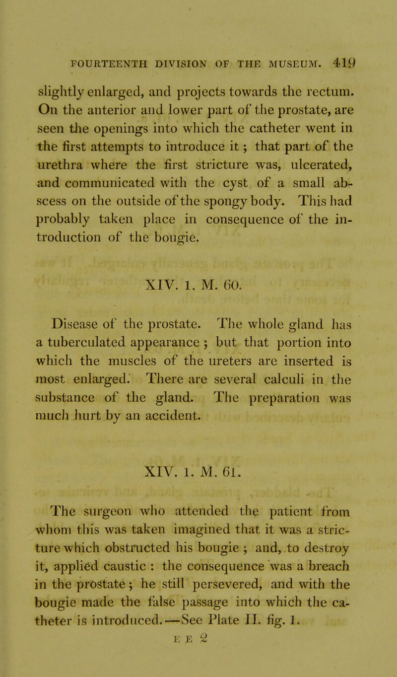 slightly enlarged, and projects towards the rectum. On the anterior and lower part of the prostate, are seen the openings into which the catheter went in the first attempts to introduce it; that part of the urethra where the first stricture was, ulcerated, and communicated with the cyst of a small ab- scess on the outside of the spongy body. This had probably taken place in consequence of the in- troduction of the bougie. XIV. 1. M. 60. Disease of the prostate. The whole gland has a tuberculated appearance ; but that portion into which the muscles of the ureters are inserted is most enlarged. There are several calculi in the substance of the gland. The preparation was much hurt by an accident. XIV. 1. M. 61. The surgeon who attended the patient from whom this was taken imagined that it was a stric- ture which obstructed his bougie ; and, .to destroy it, applied caustic : the consequence was a breach in the prostate; he still persevered, and with the bougie made the false passage into which the ca- theter is introduced.—See Plate II. fig. 1.