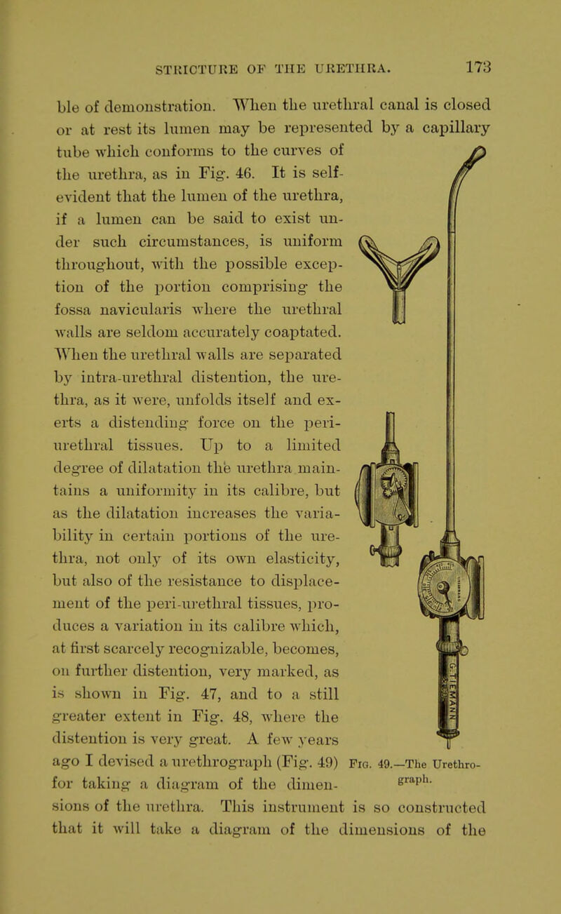 ble of demonstration. When the urethral canal is closed or at rest its lumen may be represented by a capillary tube which conforms to the curves of the urethra, as in Fig. 46. It is self- evident that the lumen of the urethra, if a lumen can be said to exist un- der such circumstances, is uniform throughout, with the possible excep- tion of the portion comprising the fossa navicularis where the urethral walls are seldom accurately coaptated. When the urethral walls are separated by intra-urethral distention, the ure- thra, as it were, unfolds itself and ex- erts a distending force on the peri- urethral tissues. Up to a limited degree of dilatation the urethra main- tains a uniformity in its calibre, but as the dilatation increases the varia- bility in certain portions of the ure- thra, not only of its own elasticity, but also of the resistance to displace- ment of the peri urethral tissues, pro- duces a variation in its calibre which, at first scarcely recognizable, becomes, on further distention, very marked, as is shown in Fig. 47, and to a still greater extent in Fig. 48, where the distention is very great. A few years ago I devised a urethrograph (Fig. 49) Fig. 49.—The Urethro- for taking a diagram of the dimen- graph, sions of the urethra. This instrument is so constructed that it will take a diagram of the dimensions of the