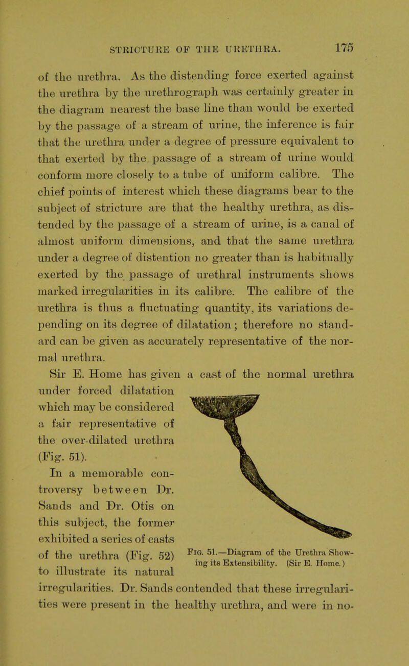 of the urethra. As the distending force exerted against the urethra by the urethrograph was certainly greater in the diagram nearest the base line than would be exerted by the passage of a stream of urine, the inference is fair that the urethra under a degree of pressure equivalent to that exerted by the passage of a stream of urine would conform more closely to a tube of uniform calibre. The chief points of interest which these diagrams bear to the subject of stricture are that the healthy urethra, as dis- tended by the passage of a stream of urine, is a canal of almost uniform dimensions, and that the same urethra under a degree of distention no greater than is habitually exerted by the passage of urethral instruments shows marked irregularities in its calibre. The calibre of the urethra is thus a fluctuating quantity, its variations de - pending on its degree of dilatation; therefore no stand- ard can be given as accurately representative of the nor- mal urethra. Sir E. Home has given a cast of the normal urethra under forced dilatation which may be considered a fair representative of the over-dilated urethra (Fig. 51). In a memorable con- troversy between Dr. Sands and Dr. Otis on this subject, the former exhibited a series of casts Of the Urethra (Fig. 52) Fia 51--Diagram of the Urethra Show- . ing its Extensibility. (Sir E. Home.) to illustrate its natural irregularities. Dr. Sands contended that these irregulari- ties were present in the healthy urethra, and were in no-