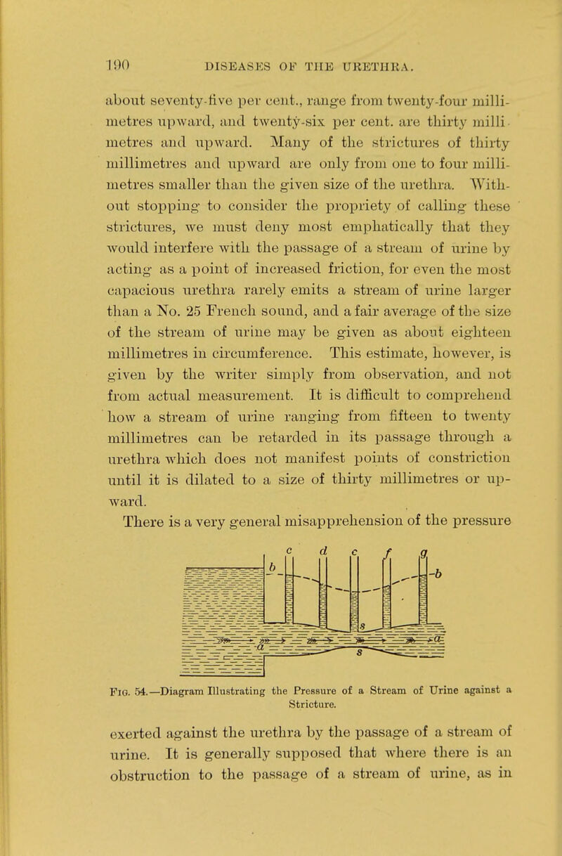 about seventy-five per cent., range from twenty-four milli- metres upward, and twenty-six per cent, are thirty milli- metres and upward. Many of the strictures of thirty millimetres and upward are only from one to four milli- metres smaller than the given size of the urethra. With- out stopping- to consider the propriety of calling these strictures, we must deny most emphatically that they would interfere with the passage of a stream of urine by acting as a point of increased friction, for even the most capacious urethra rarely emits a stream of urine larger than a No. 25 French sound, and a fair average of the size of the stream of urine may be given as about eighteen millimetres in circumference. This estimate, however, is given by the writer simply from observation, and not from actual measurement. It is difficult to comprehend how a stream of urine ranging from fifteen to twenty millimetres can be retarded in its passage through a urethra which does not manifest points of constriction until it is dilated to a size of thirty millimetres or up- ward. There is a very general misapprehension of the pressure d f -b Fig. 54.—Diagram Illustrating the Pressure of a Stream of Urine against a Stricture. exerted against the urethra by the passage of a stream of urine. It is generally supposed that where there is an obstniction to the passage of a stream of urine, as in