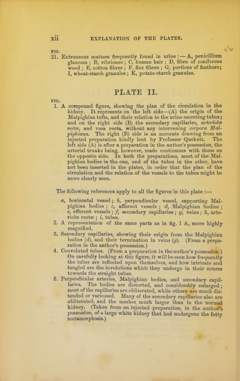 PIG. _ , 21. Extraneous matters frequently found in urine: — A, penicillium glaucum ; B, vibriones ; C, human hair ; D, fibre of coniferous wood ; E, cotton fibres ; F, flax fibres ; G, portions of feathers; I, wheat-starch granules ; K, potato-starch granules. PLATE II. FIG. 1. A compound figure, showing the plan of the circulation in the kidney. It represents on the left side—(A) the origin of the Malpighian tufts, and their relation to the urine-secreting tubes; and on the right side (B) the secondary capillaries, arterioloB rectcB, and vasa recta, without any intervening coi'pora MaZ- X>ighiana. The right (B) side is an accurate drawing from an injected preparation kindly lent by Professor Quekett. The left side (A) is after a preparation in the author’s possession, the arterial trunks being, however, made continuous with those on the opposite side. In both the preparations, most of the Mal- pighian bodies in the one, and of the tubes in the other, have not been inserted in the plates, in order that the plan of the circulation and the relation of the vessels to the tubes might be more clearly seen. The following references apply to all the figures in this plate :— a, horizontal vessel; b, perpendicular vessel, supporting Mal- pighian bodies ; c, afferent vessels ; d, Malpighian bodies ; e, efferent vessels ; /, secondary capillaries ; g, veins; h, arte- rioljje rectae ; i, tubes. 2. A representation of the same parts as in fig. 1 A, more highly magnified. 3. Secondary capillaries, showing their origin from the Malpighian bodies (d), and their termination in veins (y). (From a pre2ia- ration in the author’s possession.) 4. Convoluted tubes. (From a preparation in the authoi’’s possession.) On carefully looking at this figure, it will be seen how frequently the tubes are reflected upon themselves, and how intricate and tangled are the involutions which they undergo in their course towards the straight tubes. 5. Perpendicular arteries, Malpighian bodies, and second.ary capil- laries. The bodies are distorted, and considerably enlarged; most of the capillaries are obliterated, while others are much dis- tended or varicosed. Many of the secondary capillaries also are obliterated, and the meshes much larger than in the normal kidney. (Taken from an injected preparation, in the author’s possession, of a large white kidney that had undergone the fatty metamorphosis.)