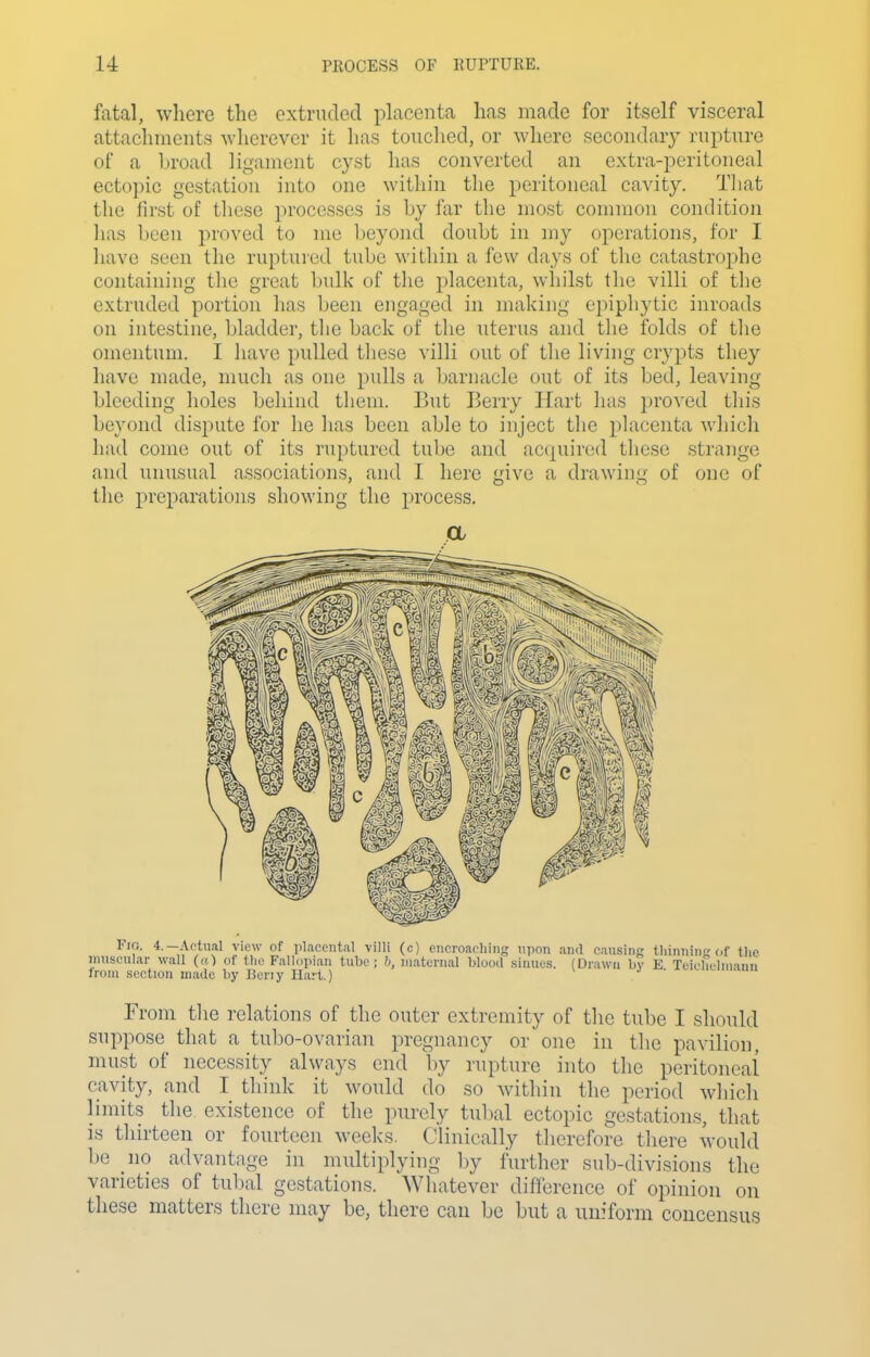 fatal, where the extruded placenta has made for itself visceral attachments wherever it has touched, or where secondary rupture of a broad ligament cyst has converted an extra-peritoneal ectopic gestation into one within the peritoneal cavity. Tliat the first of these processes is by i'ar the most common condition has been proved to me l)eyond doubt in my operations, for I have seen the ruptured tube within a few days of the catastrophe containing the great bulk of tlie placenta, whilst the villi of the extruded portion has been engaged in making epiphytic inroads on intestine, bladder, the back of the uterus and the folds of the omentum. I have pulled these villi out of the living crypts they have made, much as one pulls a barnacle out of its bed, leaving bleeding holes behind them. But Berry Hart has proved this beyond dispute for he has been able to inject the placenta which had come out of its ruptured tube and acquired these strange and unusual associations, and I here give a drawing of one of the preparations showing the process. Fig. 4.—Actual view of iilaccntal villi (c) encroaching upon and causing tliinnin of tlie muscular wall (a) of tlie Fallopian tube; h, iiiatevnal blood sinues. (Drawn by E Teiuhclniaun from section made by Beny Hart.) From the relations of the outer extremity of tlie tube I should suppose that a tubo-ovarian pregnancy or one in the pavilion, must of necessity always end by rupture into the peritoncai cavity, and I think it would do so within the period which limits the existence of the purely tubal ectopic gestations, that is thirteen or fourteen weeks. Clinically therefore there would be no advantage in multiplying by further sub-divisions the varieties of tubal gestations. Whatever difference of opinion on these matters there may be, there can be but a uniform concensus