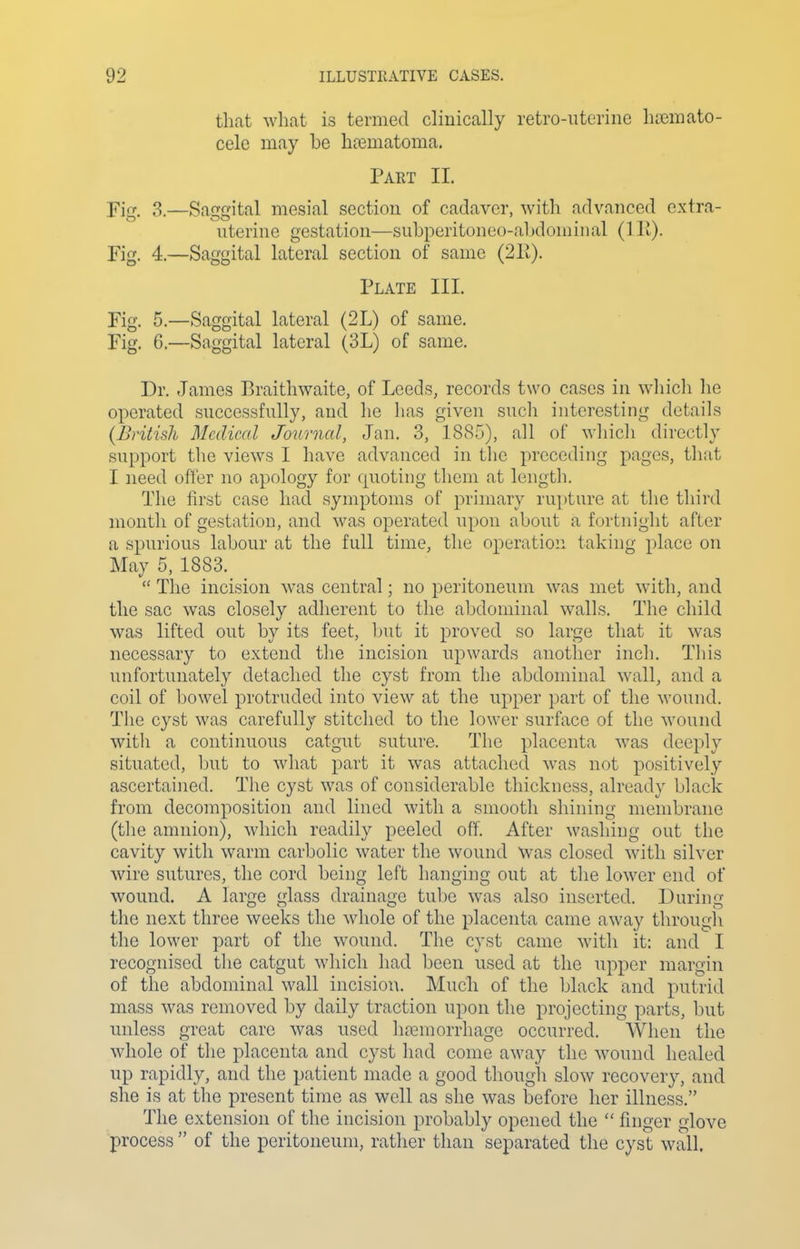 that what is termed clinically retro-uterine htemato- cele may be haimatoma. Part II. Fig. 3.—Saggital mesial section of cadaver, with advanced extra- uterine gestation—suljperitone()-al)doniinal (lit). Fig. 4.—Saggital lateral section of same (211). Plate III. Fig. 5.—Saggital lateral (2L) of same. Fig. 6.—Saggital lateral (3L) of same. Dr. James Braithwaite, of Leeds, records two cases in which he operated successfully, and lie lias given such interesting details {British Medical Journal, Jan. 3, 1885), all of wliich directly support the views I have advanced in the preceding pages, tluit I need offer no apology for quoting them at length. The first case had symptoms of primary rupture at the third month of gestation, and was operated upon about a fortnight after a spurious labour at the full time, the operation taking place on May 5, 1883.  The incision was central; no peritoneum was met with, and the sac was closely adherent to the abdominal walls. The child was lifted out by its feet, but it proved so large that it was necessary to extend the incision upwards another inch. This unfortunately detached the cyst from the abdominal wall, and a coil of l)Owel protruded into view at the upper part of the wound. The cyst was carefully stitched to the lower surface of the wound witli a continuous catgut suture. The placenta was deeply situated, but to what part it was attached was not positively ascertained. The cyst was of considerable thickness, already black from decomposition and lined with a smooth shining membrane (the amnion), which readily peeled off. After washing out the cavity with warm carbolic water the wound was closed with silver wire sutures, the cord being left hanging out at the lower end of wound. A large glass drainage tube was also inserted. During the next three weeks the whole of the placenta came away through the lower part of the wound. The cyst came with it: and I recognised the catgut which had been used at the upper margin of the abdominal wall incision. Much of the black and putrid mass was removed by daily traction upon the projecting parts, but unless great care was used hemorrhage occurred. When the whole of the placenta and cyst had come away the wound healed up rapidly, and the patient made a good though slow recovery, and she is at the present time as well as she was before her illness. The extension of the incision probably opened the  finger glove process  of the peritoneum, rather than separated the cyst wall.