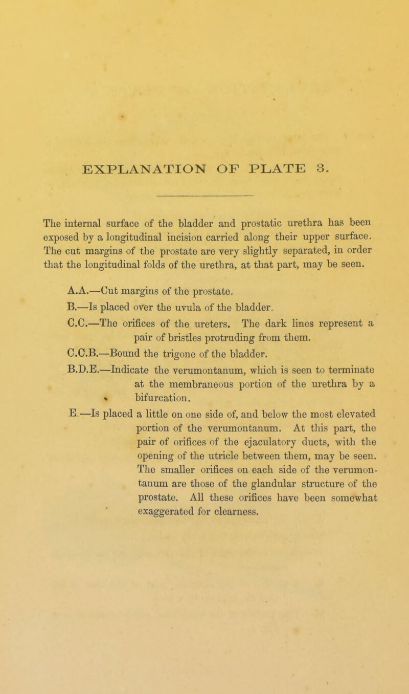 The internal surface of the bladder and prostatic urethra has been exposed by a longitudinal incision carried along their upper surface. The cut margins of the prostate are very slightly separated, in order that the longitudinal folds of the urethra, at that part, may be seen. A. A.—Cut margins of the prostate. B. —Is placed over the uvula of the bladder. C. C.—The orifices of the ureters. The dark lines represent a pair of bristles protruding from them. C.C.B.—Bound the trigone of the bladder. B.D.E.—Indicate the verumontanum, which is seen to terminate at the membraneous portion of the urethra by a » bifurcation. E.—Is placed a little on one side of, and below the most elevated portion of the verumontanum. At this part, the pair of orifices of the ejaculatory ducts, with the opening of the utricle between them, may be seen. The smaller orifices on each side of the verumon- tanum are those of the glandular structure of the prostate. All these orifices have been somewhat exaggerated for clearness.