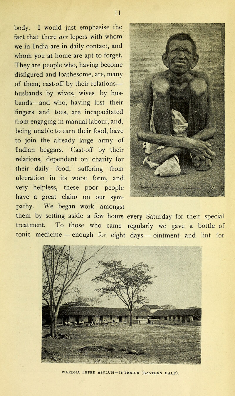 body. I would just emphasise the fact that there are lepers with whom we in India are in daily contact, and whom you at home are apt to forget. They are people who, having become disfigured and loathesome, are, many of them, cast-off by their relations— husbands by wives, wives by hus- bands—and who, having lost their fingers and toes, are incapacitated from engaging in manual labour, and, being unable to earn their food, have to join the already large army of Indian beggars. Cast-off by their relations, dependent on charity for their daily food, suffering from ulceration in its worst form, and very helpless, these poor people have a great claim on our sym- pathy. We began work amongst them by setting aside a few hours every Saturday for their special treatment. To those who came regularly we gave a bottle of tonic medicine — enough for eight days — ointment and lint for