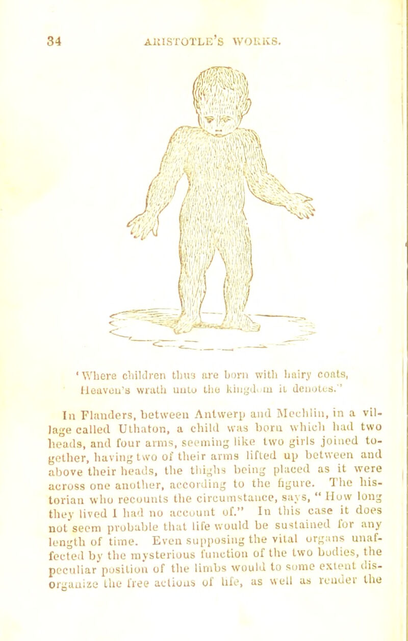 'Whore cliilclren tlju'j lire Lorn with hniry coats, Uoavou'8 wriith uutu tho kingd. m ii denotes.  In Fhmders, hetweeu Anlwery and MoL-liliii, in a vil- lage called Uthaton, a child was boni which had two heads, and four arms, seeming like two girls joined to- gether, having two of their arras lifted up between and above their heads, the thighs being placed as it were across one another, according to the figure. The his- torian who recounts the circumstance, says,  Mow long they lived 1 had no account of. In tliis case it does not seem probable that life would be sustained for any length of time. Even supposing the vital orgnns unaf- fected by the mysterious function of the two bodies, the peculiar position of the limbs would to some extent dis- organize the free actions of bfe, as well as render the