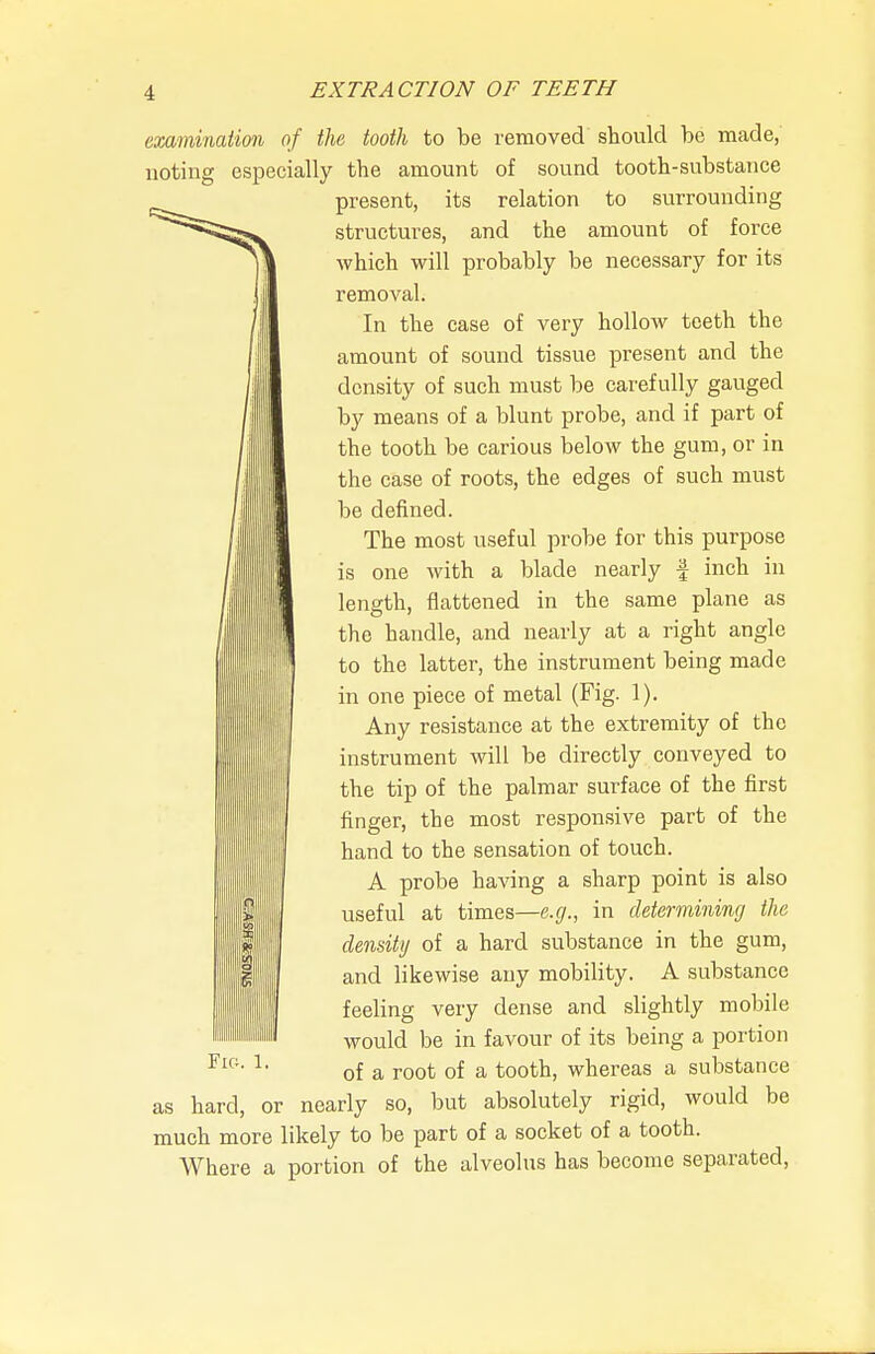 examination of the tooth to be removed should be made,' noting especially the amount of sound tooth-substance present, its relation to surrounding structures, and the amount of force which will probably be necessary for its removal. In the case of very hollow teeth the amount of sound tissue present and the density of such must be carefully gauged by means of a blunt probe, and if part of the tooth be carious below the gum, or in the case of roots, the edges of such must be defined. The most useful probe for this purpose is one with a blade nearly f inch in length, flattened in the same plane as the handle, and nearly at a right angle to the latter, the instrument being made in one piece of metal (Fig. 1). Any resistance at the extremity of the instrument will be directly conveyed to the tip of the palmar surface of the first finger, the most responsive part of the hand to the sensation of touch. A probe having a sharp point is also useful at times—e.g., in determining the density of a hard substance in the gum, and likewise any mobility. A substance feeling very dense and slightly mobile would be in favour of its being a portion of a root of a tooth, whereas a substance as hard, or nearly so, but absolutely rigid, would be much more likely to be part of a socket of a tooth. Where a portion of the alveolus has become separated. if fas 1^ I S Fig. 1.