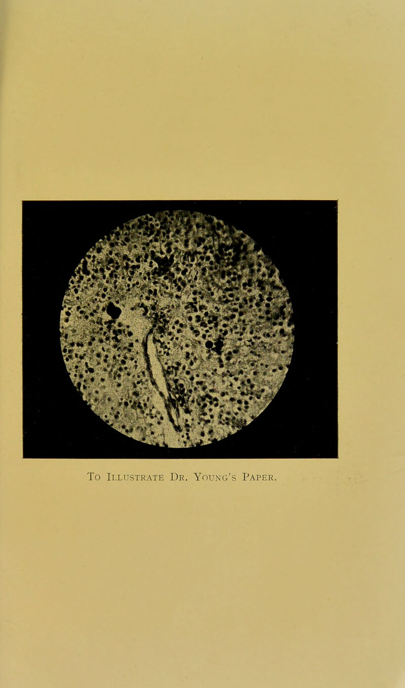 To Illustrate Dr. Young's Paper.