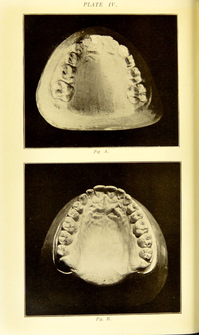 PLATE IV. Fig. B.