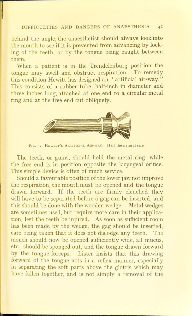 behind the angle, the anaesthetist should always look into the mouth to see if it is prevented from advancing by lock- ing of the teeth, or by the tongue being caught between them. When a patient is in the Trendelenburg position the tongue may swell and obstruct respiration. To remedy this condition Hewitt has designed an  artificial air-way. This consists of a rubber tube, half-inch in diameter and three inches long, attached at one end to a circular metal ring and at the free end cut obliquely. Fig. 4.—Hewitt's Artificial Air-way. Half the natural size The teeth, or gums, should hold the metal ring, while the free end is in position opposite the laryngeal orifice. This simple device is often of much service. Should a favourable position of the lower jaw not improve the respiration, the mouth must be opened and the tongue drawn forward. If the teeth are firmly clenched they will have to be separated before a gag can be inserted, and this should be done with the wooden wedge. Metal wedges are sometimes used, but require more care in their applica- tion, lest the teeth be injured. As soon as sufficient room has been made by the wedge, the gag should be inserted, care being taken that it does not dislodge any teeth. The mouth should now be opened sufficiently wide, all mucus, etc., should be sponged out, and the tongue drawn forward by the tongue-forceps. Lister insists that this drawing forward of the tongue acts in a reflex manner, especially in separating the soft parts above the glottis which may have fallen together, and is not simply a removal of the