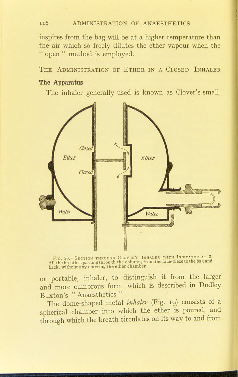 inspires from the bag wUl be at a higher temperature than the air which so freely dilutes the ether vapour when the  open  method is employed. The Administration of Ether in a Closed Inhaler The Apparatus The inhaler generally used is known as Clover's small, Fig. 20—Section through Clover's Inhaler with Indicator at 0. All the breath is passing through the column, from the face-piece to the bag and back, without any entering the ether chamber or portable, inhaler, to distinguish it from the larger and more cumbrous form, which is described in Dudley Buxton's  Anaesthetics. The dome-shaped metal inhaler (Fig. 19) consists of a spherical chamber into which the ether is poured, and through which the breath circulates on its way to and from