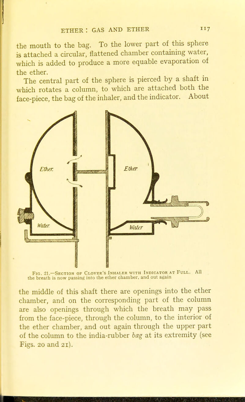 the mouth to the bag. To the lower part of this sphere is attached a circular, flattened chamber containing water, which is added to produce a more equable evaporation of the ether. The central part of the sphere is pierced by a shaft in which rotates a column, to which are attached both the face-piece, the bag of the inhaler, and the indicator. About Fig. 21.—Section of Clover's Inhaler with Indicator at Full. All the breath is now passint! into the ether chamber, and out attain the middle of this shaft there are openings into the ether chamber, and on the corresponding part of the column are also openings through which the breath may pass from the face-piece, through the column, to the interior of the ether chamber, and out again through the upper part of the column to the india-rubber bag at its extremity (see Figs. 20 and 21).