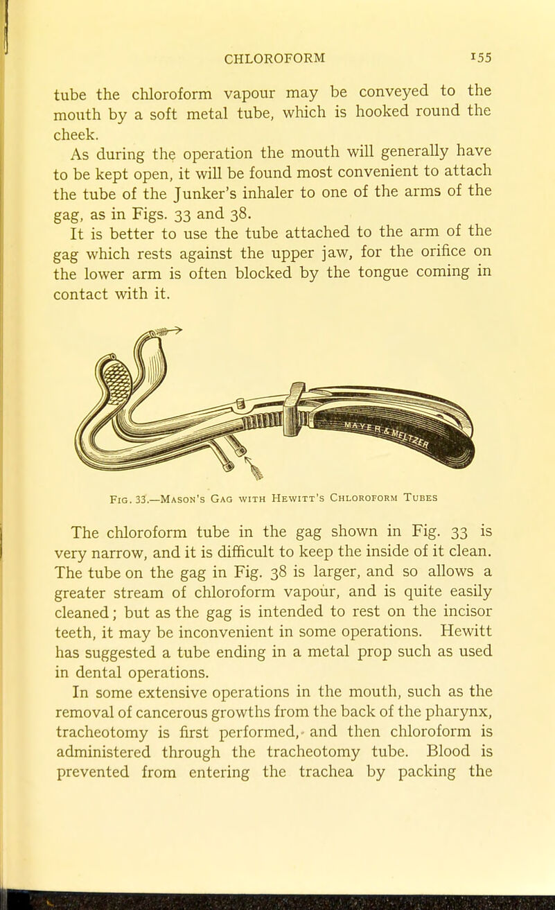 tube the chloroform vapour may be conveyed to the mouth by a soft metal tube, which is hooked round the cheek. As during the operation the mouth will generally have to be kept open, it will be found most convenient to attach the tube of the Junker's inhaler to one of the arms of the gag, as in Figs. 33 and 38. It is better to use the tube attached to the arm of the gag which rests against the upper jaw, for the orifice on the lower arm is often blocked by the tongue coming in contact with it. Fig. 33.—Mason's Gag with Hewitt's Chloroform Tubes The chloroform tube in the gag shown in Fig. 33 is very narrow, and it is difficult to keep the inside of it clean. The tube on the gag in Fig. 38 is larger, and so allows a greater stream of chloroform vapour, and is quite easily cleaned; but as the gag is intended to rest on the incisor teeth, it may be inconvenient in some operations. Hewitt has suggested a tube ending in a metal prop such as used in dental operations. In some extensive operations in the mouth, such as the removal of cancerous growths from the back of the pharynx, tracheotomy is first performed, - and then chloroform is administered through the tracheotomy tube. Blood is prevented from entering the trachea by packing the