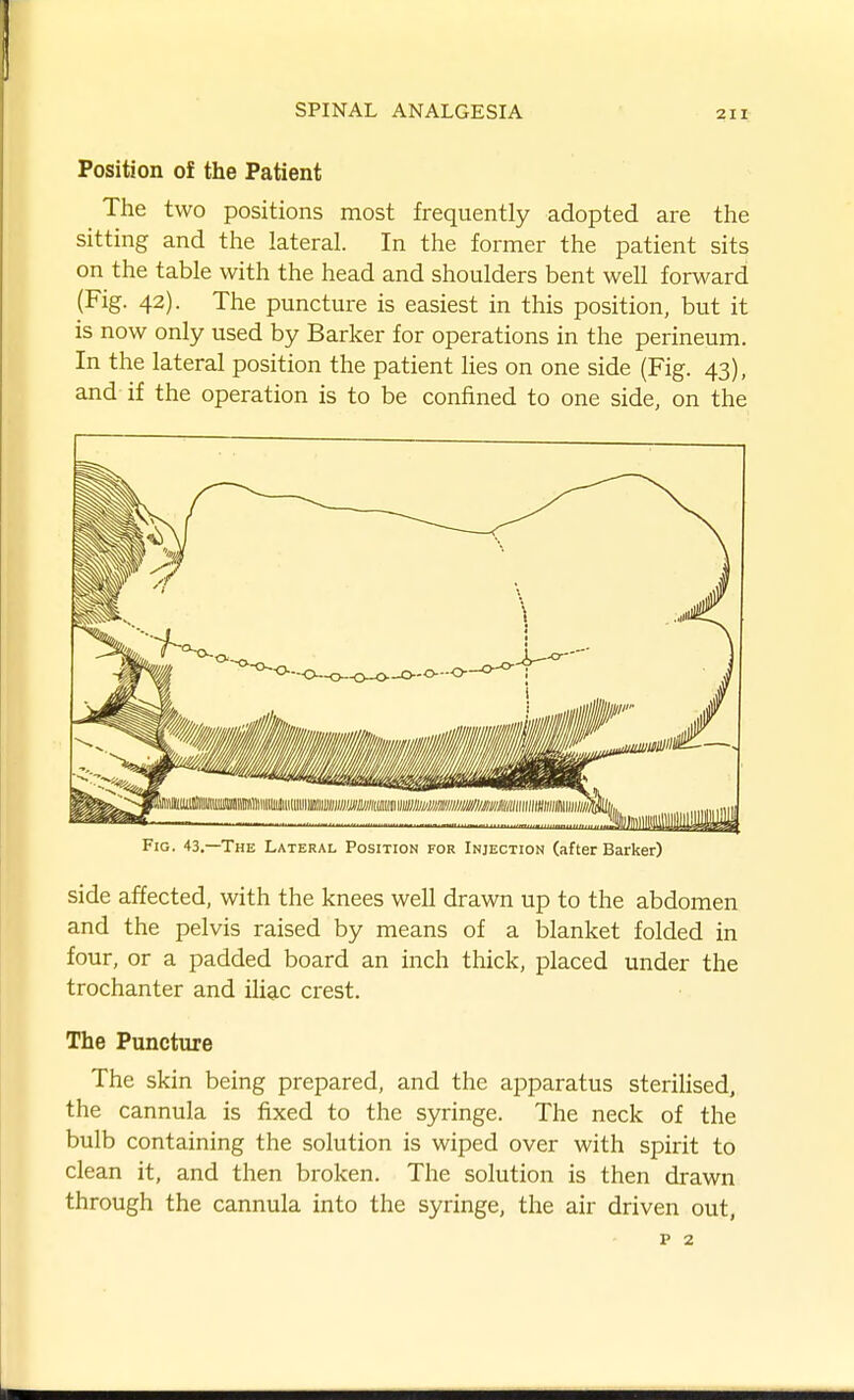 211: Position of the Patient The two positions most frequently adopted are the sitting and the lateral. In the former the patient sits on the table with the head and shoulders bent well forward (Fig. 42). The puncture is easiest in this position, but it is now only used by Barker for operations in the perineum. In the lateral position the patient lies on one side (Fig. 43), and if the operation is to be confined to one side, on the Fig. 43.—The Lateral Position for Injection (after Barker) side affected, with the knees well drawn up to the abdomen and the pelvis raised by means of a blanket folded in four, or a padded board an inch thick, placed under the trochanter and iliac crest. The Puncture The skin being prepared, and the apparatus sterilised, the cannula is fixed to the syringe. The neck of the bulb containing the solution is wiped over with spirit to clean it, and then broken. The solution is then drawn through the cannula into the syringe, the air driven out,