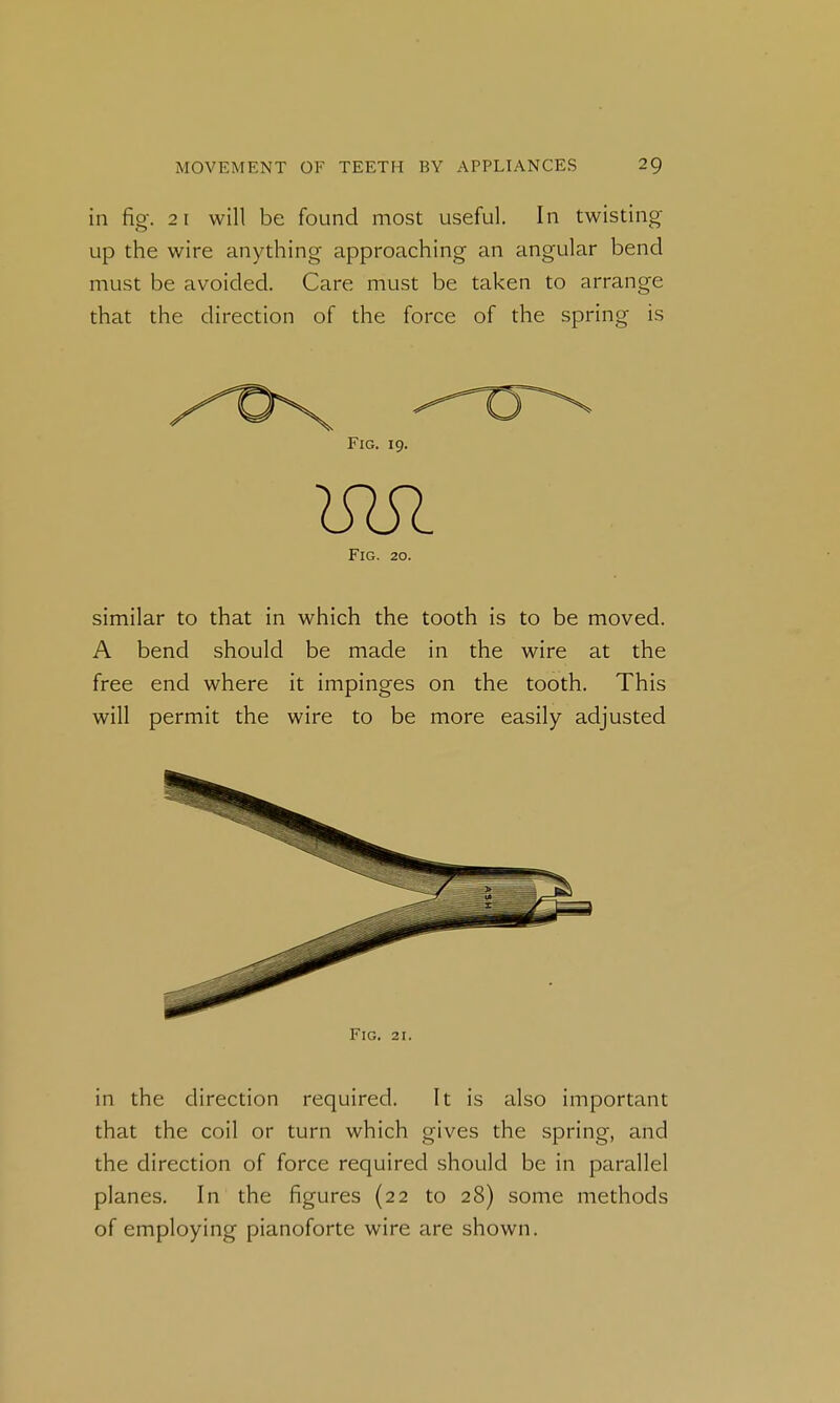 in fig. 2 1 will be found most useful. In twisting up the wire anything approaching an angular bend must be avoided. Care must be taken to arrange that the direction of the force of the spring is Fig, 19. mi Fig. 20. similar to that in which the tooth is to be moved. A bend should be made in the wire at the free end where it impinges on the tooth. This will permit the wire to be more easily adjusted Fig. 21. in the direction required. It is also important that the coil or turn which gives the spring, and the direction of force required should be in parallel planes. In the figures (22 to 28) some methods of employing pianoforte wire are shown.