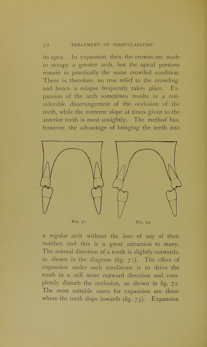 its apex. In expansion, then, the crowns are made to occupy a greater arch, but the apical portions remain in practically the same crowded condition. There is, therefore, no true relief to the crowding and hence a relapse frequently takes place. Ex- pansion of the arch sometimes results in a con- siderable disarrangement of the occlusion of the teeth, while the extreme slope at times given to the anterior teeth is most unsightly. The method has, however, the advantage of bringing the teeth into Fig. 71. Fig. 72. a regular arch without the loss of any of their number, and this is a great attraction to many. The normal direction of a tooth is slightly outwards, as shown in the diagram (fig. 71). The effect of expansion under such conditions is to drive the tooth in a still more outward direction and com- pletely disturb the occlusion, as shown in fig. 72. The most suitable cases for expansion are those where the teeth slope inwards (fig. 73). Expansion