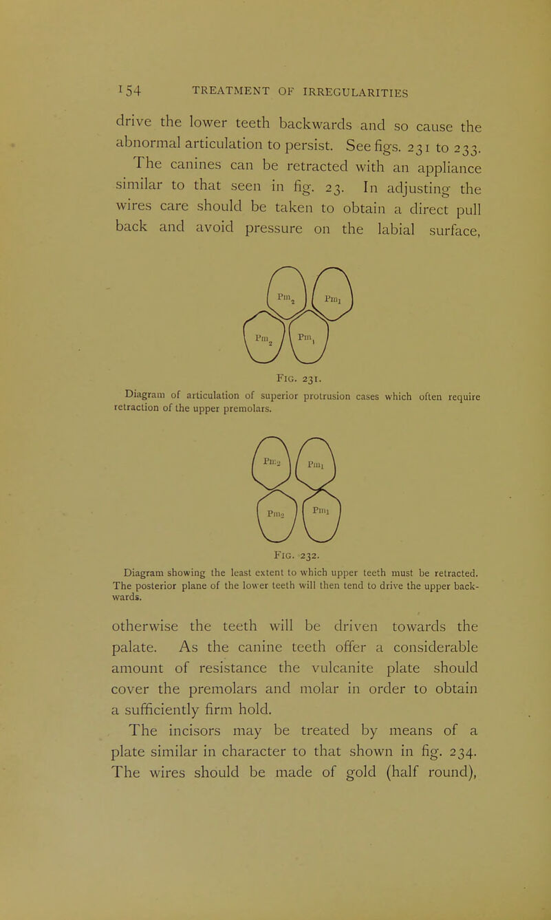 drive the lower teeth backwards and so cause the abnormal articulation to persist. See figs. 231 to 233. The canines can be retracted with an appliance similar to that seen in fig. 23. In adjusting the wires care should be taken to obtain a direct pull back and avoid pressure on the labial surface, Fig. 231. Diagram of articulation of superior protrusion cases which often require retraction of the upper premolars. Fig. 232. Diagram showing the least extent to which upper teeth must be retracted. The posterior plane of the lower teeth will then tend to drive the upper back- wards. Otherwise the teeth will be driven towards the palate. As the canine teeth offer a considerable amount of resistance the vulcanite plate should cover the premolars and molar in order to obtain a sufficiently firm hold. The incisors may be treated by means of a plate similar in character to that shown in fig. 234. The wires should be made of gold (half round),