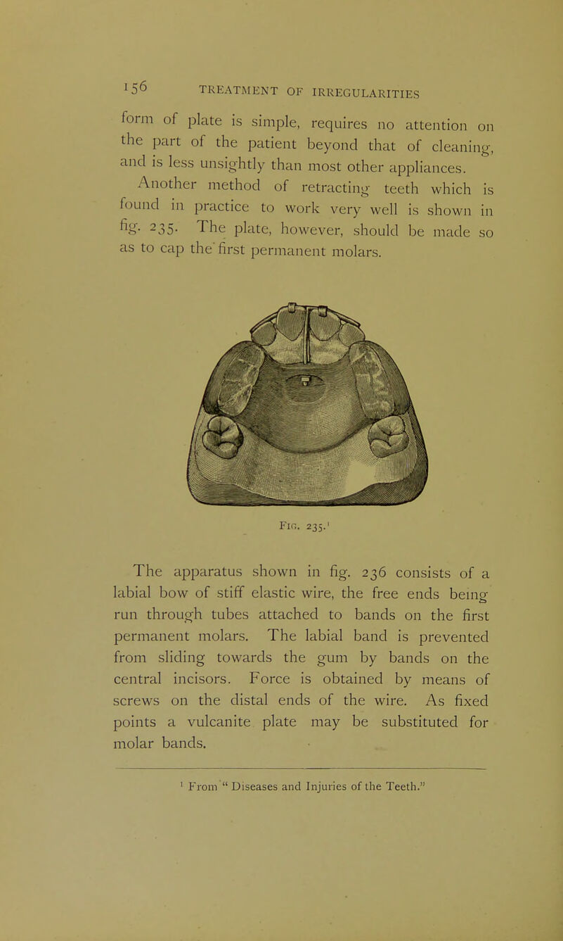 form of plate is simple, requires no attention on the part of the patient beyond that of cleaning, and is less unsightly than most other appliances. Another method of retracting teeth which is found in practice to work very well is shown in %• 235. The plate, however, should be made so as to cap the' first permanent molars. Fig. 235.' The apparatus shown in fig. 236 consists of a labial bow of stiff elastic wire, the free ends bemg- run through tubes attached to bands on the first permanent molars. The labial band is prevented from sliding towards the gum by bands on the central incisors. Force is obtained by means of screws on the distal ends of the wire. As fixed points a vulcanite plate may be substituted for molar bands. ' From  Diseases and Injuries of the Teeth.