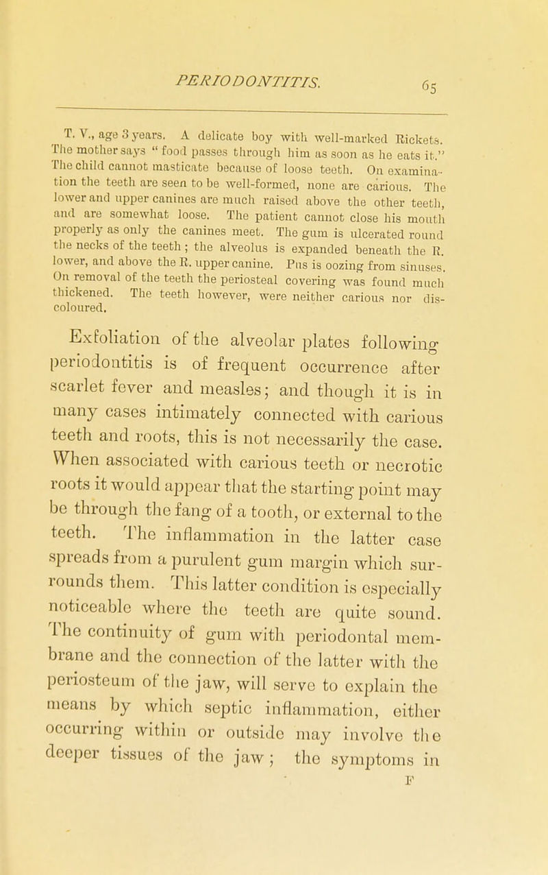 ^ ^ T. v., age 3 years. A delicate boy with well-marked Rickets. The mother says  fooil passes through him as soon as he eats it. The child cannot masticate because of loose teeth. On examina-- tion the teeth are seen to be well-formed, none are carious. The lower and upper canines are much raised above the other teeth, and are somewhat loose. The patient cannot close his moutli properly as only the canines meet. The gum is ulcerated round the necks of the teeth ; the alveolus is expanded beneath the R. lower, and above the R. upper canine. Pus is oozing from sinuses. On removal of the teeth the periosteal covering was found mucli thickened. The teeth however, were neither carious nor tlis- coloured. Exfoliation of the alveolar plates following periodontitis is of frequent occurrence after scarlet fever and measles; and tliougli it is in many ca.ses intimately connected with carious teeth and roots, this is not necessarily the case. When associated with carious teeth or necrotic roots it would appear that the starting point may be through the fang of a tooth, or external to the teeth. The inflammation in the latter case spreads from a purulent gum margin which sur- rounds them. This latter condition is especially noticeable where the teeth are quite sound. The continuity of gum with periodontal mem- brane and the connection of the latter with the periosteum of the jaw, will serve to explain the means by which septic inflammation, either occurring within or outside may involve tlie deeper tissues of the jaw; the symptoms in