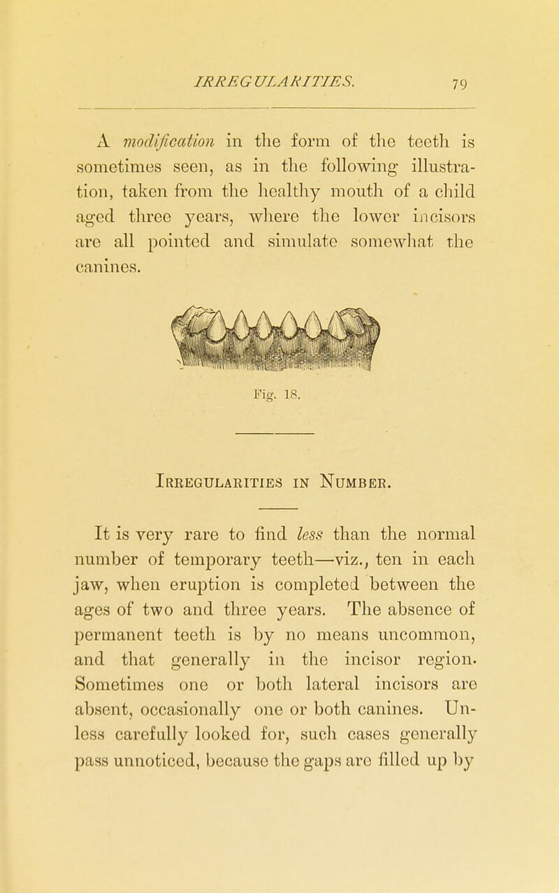 A modification in the form of the teeth is sometimes seen, as in the following illustra- tion, taken from the healthy mouth of a child aged tliree years, where the lower incisors are all pointed and simulate somewliat the canines. Fig. 18. Irregularities in Number. It is very rare to find less than the normal number of temporary teeth—viz., ten in each jaw, when eruption is completed between the ages of two and three years. The absence of permanent teeth is by no means uncommon, and that generally in the incisor region. Sometimes one or both lateral incisors are absent, occasionally one or both canines. Un- less carefully looked for, such cases generally pass unnoticed, because the gajDS are filled up by