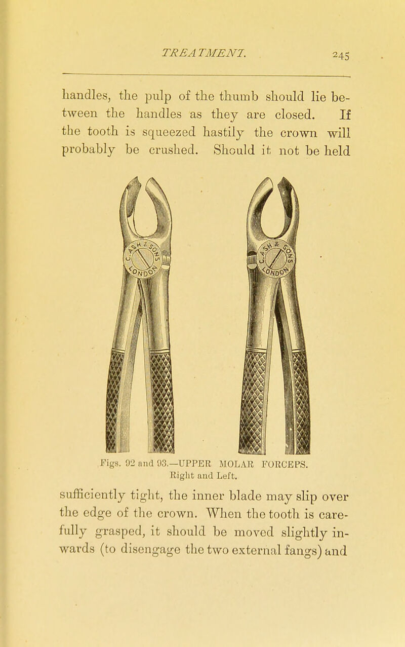 handles, the pulp of the thumb should lie be- tween the handles as they are closed. If the tooth is squeezed hastily the crown will probably be crushed. Should it not be held Figs. 92 and 03.—UPPER MOLAR FORCEPS. Right and Left. sufficiently tight, the inner blade may slip over the edge of the crown. When the tooth is care- fully grasped, it should be moved slightly in- wards (to disengage the two external fangs) and