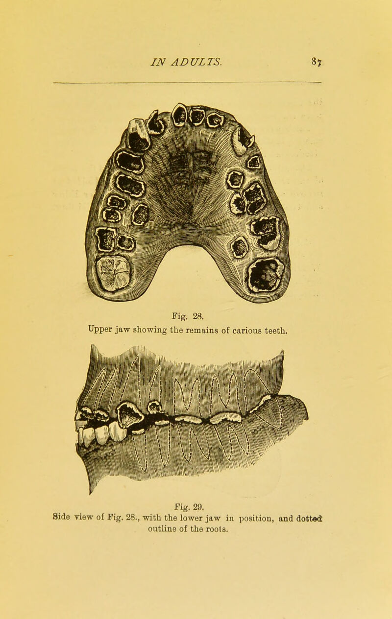 Fig. 29. Side view of Fig. 28., with the lower jaw in position, and dotted outline of the roots.