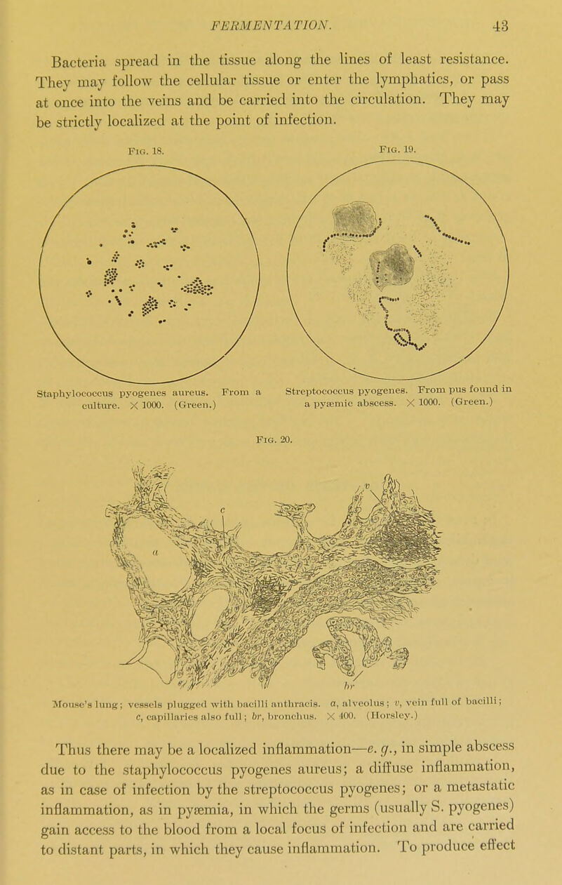 Bacteria spread in the tissue along the lines of least resistance. They may follow the cellular tissue or enter the lymphatics, or pass at once into the veins and be carried into the circulation. They may be strictly localized at the point of infection. Fig. 18. Fig. 19. Mou.se's lung; vessels plugK'nl with bacilli anthracis. o, alveolus; v, vein full of bacilli; C, capillaries also full ; 6?-, bi-onchus. X 100. (Hm-sley.) Thus there may be a localized inflammation—e. g., in simple abscess due to the staphylococcus pyogenes aureus; a diffuse inflammation, as in case of infection by the streptococcus pyogenes; or a metastatic inflammation, as in pyaemia, in which the germs (usually S. pyogenes) gain access to the blood from a local focus of infection and are carried to distant parts, in which they cause inflammation. To produce eftect