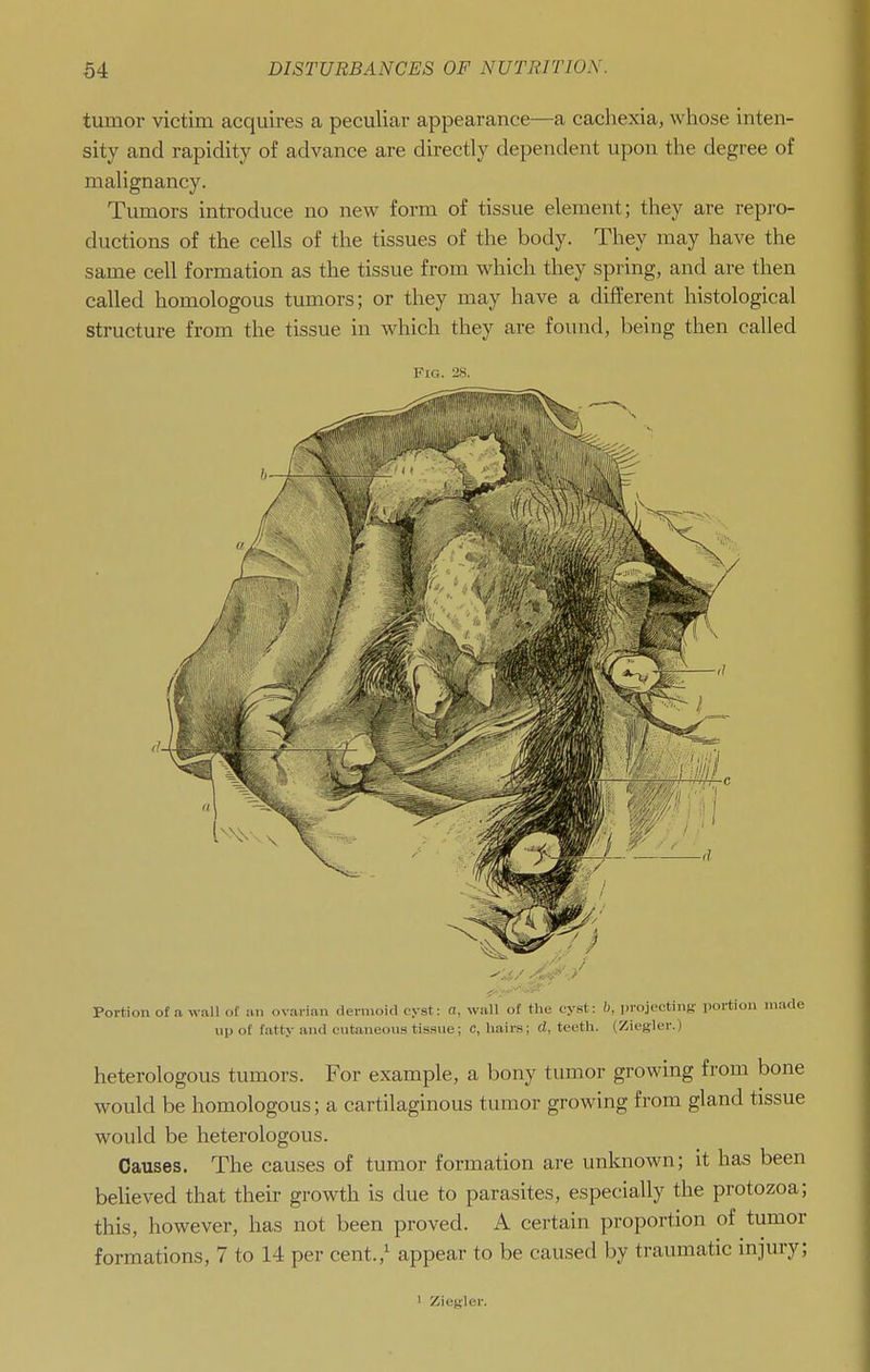 tumor victim acquires a peculiar appearance—a cachexia, whose inten- sity and rapidity of advance are directly dependent upon the degree of malignancy. Tumors introduce no new form of tissue element; they are repro- ductions of the cells of the tissues of the body. They may have the same cell formation as the tissue from which they spring, and are then called homologous tumors; or they may have a different histological structure from the tissue in which they are found, being then called Fig. 28. Portion of ti wall of an ovarian dermoid cyst: a, wall of the cyst: b, in-ojectiny: portion made up of fatty and cutaneous tis.sue; c, hairs; d, teeth. (Ziegler.) heterologous tumors. For example, a bony tumor growing from bone would be homologous; a cartilaginous tumor growing from gland tissue would be heterologous. Causes. The causes of tumor formation are unknown; it has been believed that their growth is due to parasites, especially the protozoa; this, however, has not been proved. A certain proportion of tumor formations, 7 to 14 per cent.,' appear to be caused by traumatic injury; 1 Ziegler.