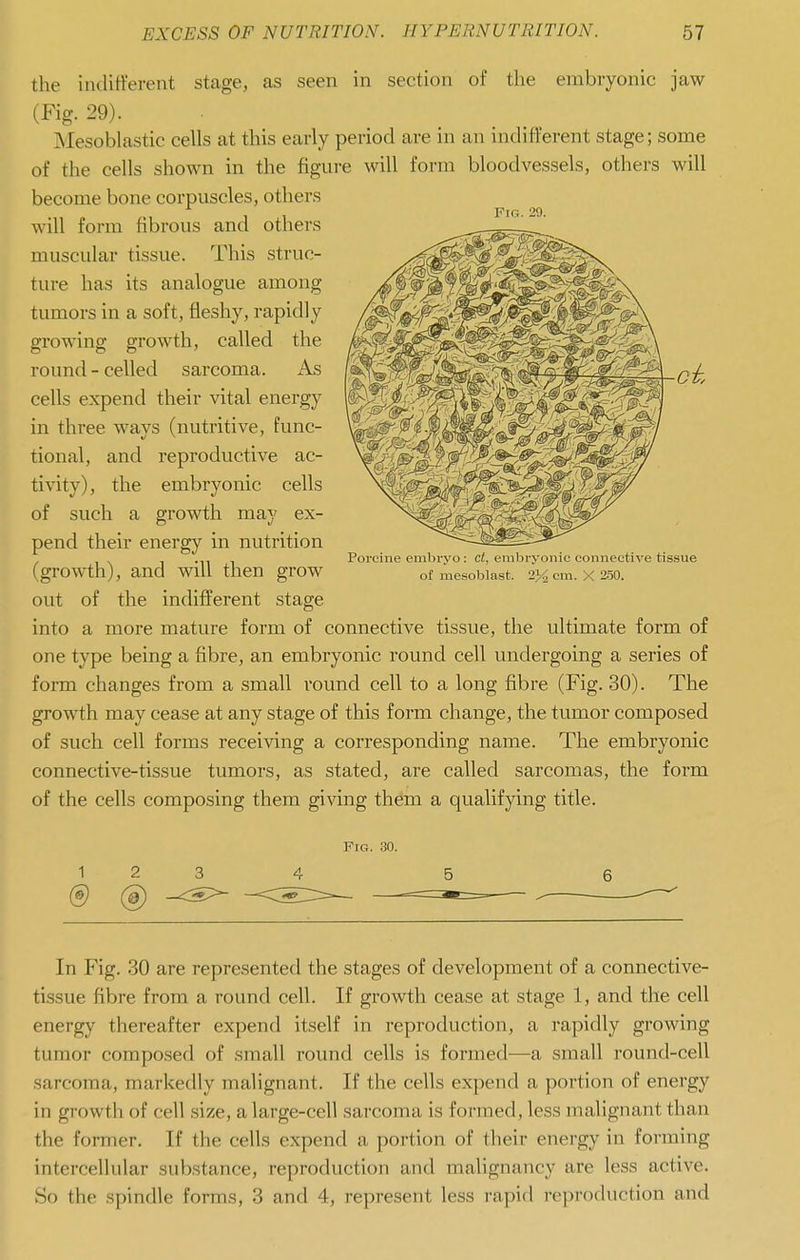 the indifferent stage, as seen in section of the embryonic jaw (Fig. 29). Mesoblastic cells at this early period are in an indifferent stage; some of the cells shown in the figure will form bloodvessels, others will become bone corpuscles, others will form fibrous and others muscular tissue. This struc- ture has its analogue among tumors in a soft, fleshy, rapidly growing growth, called the round - celled sarcoma. As cells expend their vital energy in three ways (nutritive, func- tional, and reproductive ac- tivity), the embryonic cells of such a growth may ex- pend their energy in nutrition (growth), and will then grow out of the indifferent stage into a more mature form of connective tissue, the ultimate form of one type being a fibre, an embryonic round cell undergoing a series of form changes from a small round cell to a long fibre (Fig. 30). The growth may cease at any stage of this form change, the tumor composed of such cell forms receiving a corresponding name. The embryonic connective-tissue tumors, as stated, are called sarcomas, the form of the cells composing them giving them a qualifying title. 1 2 3 (e) @ -c^ In Fig. 30 are represented the stages of development of a connective- tissue fibre from a round cell. If growth cease at stage 1, and the cell energy thereafter expend itself in reproduction, a rapidly growing tumor composed of small round cells is formed—a small round-cell sarcoma, markedly malignant. If the cells expend a portion of energy in growth of cell size, a large-cell sarcoma is formed, less malignant than the former. If the cells expend a portion of their energy in forming intercellular substance, reproduction and malignancy are less active. So the spindle forms, 3 and 4, represent less rapid reproduction and Fig. 29. Porcine embryo : ct, embryonic connective tissue of mesoblast. 2}i cm. X 2-50. Fig. 30.