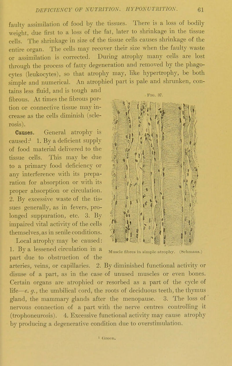 faulty assimilation of food by the tissues. There is a loss of bodily weight, due first to a loss of the fat, later to shrinkage in the tissue cells. The shrinkage in size of the tissue cells causes shrinkage of the entire organ. The cells may recover their size when the faulty waste or assimilation is corrected. During atrophy many cells are lost through the process of fatty degeneration and removed by the phago- cytes (leukocytes), so that atrophy may, like hypertrophy, be both simple and numerical. An atrophied part is pale and shrunken, con- tains less fluid, and is tough and fibrous. At times the fibrous por- tion or connective tissue may in- crease as the cells diminish (scle- rosis). Causes. General atrophy is caused:^ 1. By a deficient supply of food material delivered to the tissue cells. This may be due to a primary food deficiency or any interference with its prepa- ration for absorption or with its proper absorption or circulation. 2. By excessive Avaste of the tis- sues generally, as in fevers, pro- longed suppuration, etc. 3. By impaired vital activity of the cells themselves, as in senile conditions. Local atrophy may be caused: 1. By a lessened circulation in a , ,., ,u i = ^ J Muscle fibres 111 simple atropliy. (Schmaus.) part due to obstruction of the arteries, veins, or capillaries. 2. By diminished functional activity or disuse of a part, as in the case of unused muscles or even bones. Certain organs are atrophied or resorbed as a part of the cycle of life—e. g., the umbilical cord, the roots of deciduous teeth, the thymus gland, the mammary glands after the menopause. 3. The loss of nervous connection of a part with the nerve centres controlling it (trophoneuro.sis). 4. Excessive functional activity may cause atrophy by producing a degenerative condition due to overstimulation. ' Orcen.