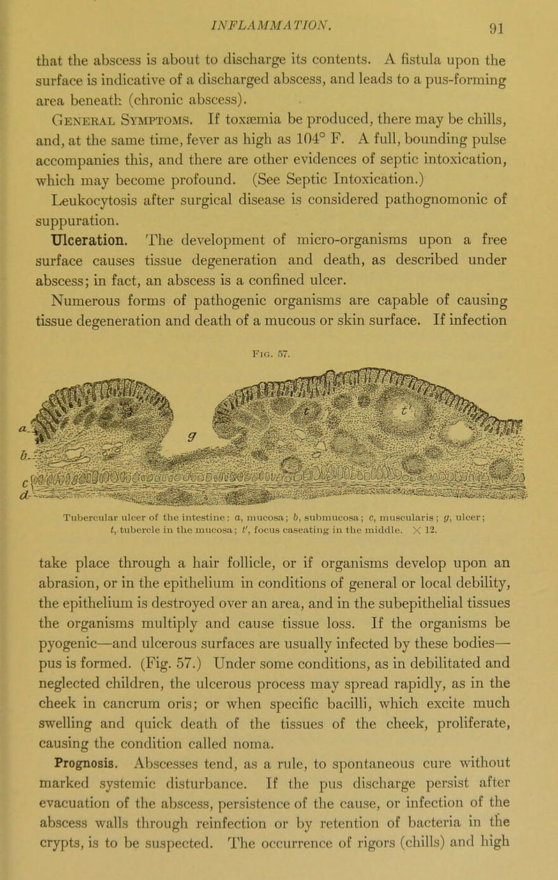 that the abscess is about to discharge its contents. A fistula upon the surface is indicative of a discharged abscess, and leads to a pus-forming area beneath (chronic abscess). General Symptoms. If toxtemia be produced, there may be chills, and, at the same time, fever as high as 104° F. A full, bounding pulse accompanies this, and there are other evidences of septic intoxication, which may become profound. (See Septic Intoxication.) Leukocytosis after surgical disease is considered pathognomonic of suppuration. Ulceration. The development of micro-organisms upon a free surface causes tissue degeneration and death, as described under abscess; in fact, an abscess is a confined ulcer. Numerous forms of pathogenic organisms are capable of causing tissue degeneration and death of a mucous or skin surface. If infection Fig. 57. Tubercular ulcer of the intestiue: o, mucosa; 6, submucosa; c, muscularis ; £/, ulcer; <, tubercle in the mucosa; V, focus caseating in the middle. X 12. take place through a hair follicle, or if organisms develop upon an abrasion, or in the epithelium in conditions of general or local debility, the epithelium is destroyed over an area, and in the subepithelial tissues the organisms multiply and cause tissue loss. If the organisms be pyogenic—and ulcerous surfaces are usually infected by these bodies— pus is formed. (Fig. 57.) Under some conditions, as in debilitated and neglected children, the ulcerous process may spread rapidly, as in the cheek in cancrum oris; or when specific bacilli, which excite much swelling and quick death of the tissues of the cheek, proliferate, causing the condition called noma. Prognosis. Abscesses tend, as a rule, to spontaneous cure without marked systemic disturbance. If the pus discharge persist after evacuation of the abscess, persistence of the cause, or infection of the abscess walls through reinfection or by retention of bacteria in the crypts, is to be suspected. The occurrence of rigors (chills) and high