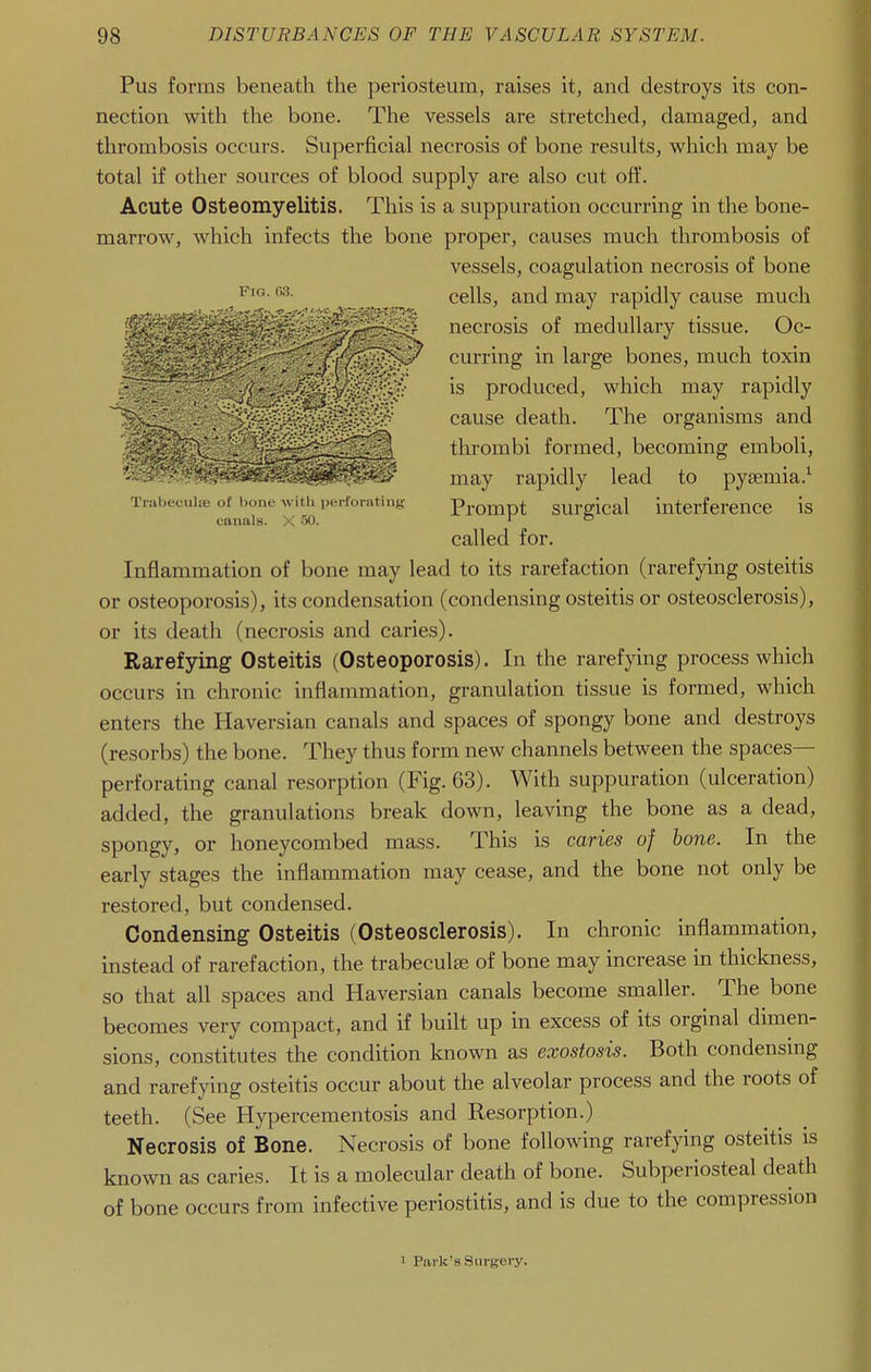 Pus forms beneath the periosteum, raises it, and destroys its con- nection with the bone. The vessels are stretched, damaged, and thrombosis occurs. Superficial necrosis of bone results, which may be total if other sources of blood supply are also cut off. Acute Osteomyelitis. This is a suppuration occurring in the bone- marrow, which infects the bone proper, causes much thrombosis of vessels, coagulation necrosis of bone cells, and may rapidly cause much ' ''^^^^'■'■■■■y:^'^^^'^^ necrosis of medullary tissue. Oc- ' '-ff^^^^^^ curring in large bones, much toxin ^-/<' produced, which may rapidly . ' cause death. The organisms and v,^^ thrombi formed, becoming emboli, *.^^^^^il^it^SS^^^^^M may rapidly lead to pyaemia.^ Tmbecuiui of bone witiuHM-forating Prompt surgical interference is canals. X 50. r o called for. Inflammation of bone may lead to its rarefaction (rarefying osteitis or osteoporosis), its condensation (condensing osteitis or osteosclerosis), or its death (necrosis and caries). Rarefying Osteitis (Osteoporosis). In the rarefying process which occurs in chronic inflammation, granulation tissue is formed, which enters the Haversian canals and spaces of spongy bone and destroys (resorbs) the bone. They thus form new channels between the spaces- perforating canal resorption (Fig. 63). With suppuration (ulceration) added, the granulations break down, leaving the bone as a dead, spongy, or honeycombed mass. This is caries of bone. In the early stages the inflammation may cease, and the bone not only be restored, but condensed. Condensing Osteitis (Osteosclerosis). In chronic inflammation, instead of rarefaction, the trabeculse of bone may increase in thickness, so that all spaces and Haversian canals become smaller. The bone becomes very compact, and if built up in excess of its orginal dimen- sions, constitutes the condition known as exostosis. Both condensing and rarefying osteitis occur about the alveolar process and the roots of teeth. (See Hypercementosis and Resorption.) Necrosis of Bone. Necrosis of bone following rarefying osteitis is known as caries. It is a molecular death of bone. Subperiosteal death of bone occurs from infective periostitis, and is due to the compression