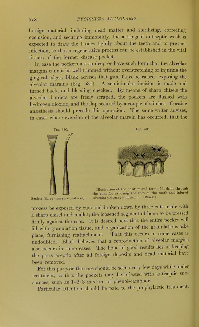 foreign material, including dead matter and sterilizing, correcting occlusion, and securing immobility, the astringent antiseptic wash is expected to draw the tissues tightly about the teeth and to prevent infection, so that a regenerative process can be established in the ^ital tissues of the former disease pocket. In case the pockets are so deep or have such form that the alveolar margins cannot be well trimmed without overstretching or injuring the gingival edges. Black advises that gum flaps be raised, exposing the alveolar margins (Fig. 531). A semicircular incision is made and turned back, and bleeding checked. By means of sharp chisels the alveolar borders are freely scraped, the pockets are flushed with hydrogen dioxide, and the flap secured by a couple of stitches. Cocaine anaesthesia should precede this operation. The same writer advises, in cases where eversion of the alveolar margin has occurred, that the Fig. 530. Fig. 531. Illustration of the position and form of incision through the gum for exposing the root of the tooth and injured Scalers (three times natural size). alveolar process : a, incision. (Black.) process be exposed by cuts and broken down by three cuts made with a sharp chisel and mallet; the loosened segment of bone to be pressed firmly against the root. It is desired next that the entire pocket will fill with granulation tissue, and organization of the granulations take place, furnishing reattachment. That this occurs in some cases is undoubted. Black beheves that a reproduction of alveolar margins also occurs in some cases. The hope of good results hes in keeping the parts aseptic after all foreign deposits and dead material have been removed. For this purpose the case should be seen every few days while under treatment, so that the pockets may be injected with antiseptic sub- stances, such as 1-2-3 mixture or phenol-camphor. Particular attention should be paid to the prophylactic treatment.