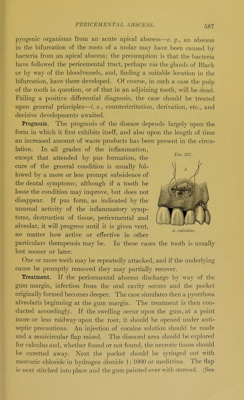 pyogenic organisms from an acute apical abscess—e. g., an abscess in the bifurcation of the roots of a molar may have been caused by bacteria from,an apical abscess; the presumption is that the bacteria have followed the pericemental tract, perhaps via the glands of Black or by way of the bloodvessels, and, finding a suitable location in the bifurcation, have there developed. Of course, in such a case the pulp of the tooth in question, or of that in an adjoining tooth, will be dead. FaiUng a positive differential diagnosis, the case should be treated upon general principles—i. e., counterirritation, derivation, etc., and decisive developments awaited. Prognosis. The prognosis of the disease depends largely upon the form in which it first exhibits itself, and also upon the length of time an increased amount of waste products has been present in the circu- lation. In all grades of the inflammation, except that attended by pus formation, the cure of the general condition is usually fol- lowed by a more or less prompt subsidence of the dental symptoms; although if a tooth be loose the condition may improve, but does not disappear. If pus form, as indicated by the unusual activity of the inflammatory symp- toms, destruction of tissue, pericemental and alveolar, it will progress until it is given vent, no matter how active or effective in other particulars therapeusis may be. In these cases the tooth is usually lost sooner or later. One or more teeth may be repeatedly attacked, and if the underlying cause be promptly removed they may partially recover. Treatment. If the pericemental abscess discharge by way of the gum margin, infection from the oral cavity occurs and the pocket originally formed becomes deeper. The case simulates then a pyorrhoea alveolaris beginning at the gum margin. The treatment is then con- ducted accordingly. If the sweUing occur upon the gum, at a point more or less midway upon the root, it should be opened under anti- septic precautions. An injection of cocaine solution should be made and a semicircular flap raised. The diseased area should be explored for calculus and, whether found or not found, the necrotic tissue should be curetted away. Next the pocket should be syringed out with mercuric chloride in hydrogen dioxide 1:1000 or meditrina. The flap is next stitched into place and the gum painted over with steresol. (See Fig. 537. A, calculus.