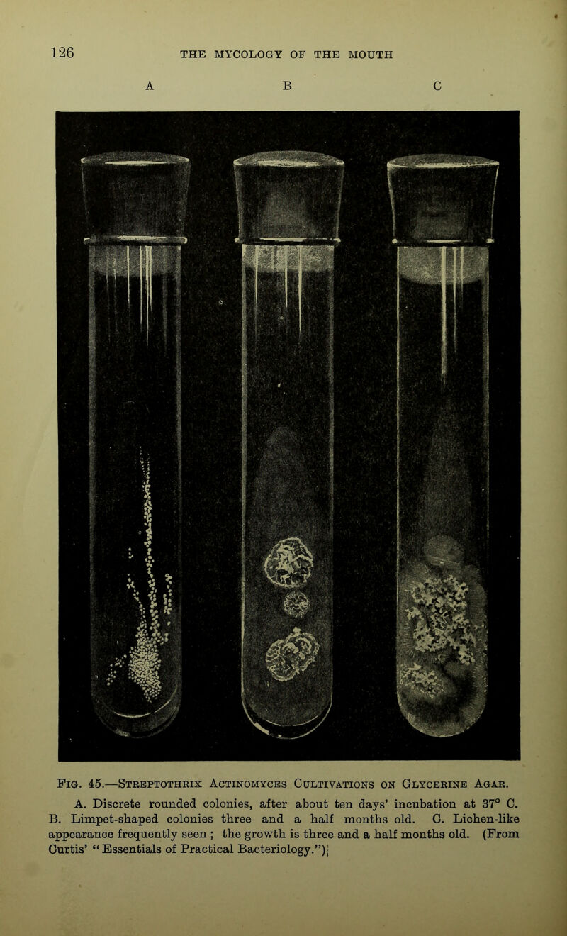 A B C Fig. 45.—Streptothrix Actinomyces Cultivations on Glycerine Agar. A. Discrete rounded colonies, after about ten days' incubation at 37° C. B. Limpet-shaped colonies three and a half months old. 0. Lichen-like appearance frequently seen ; the growth is three and a half months old. (From Curtis'  Essentials of Practical Bacteriology.)]