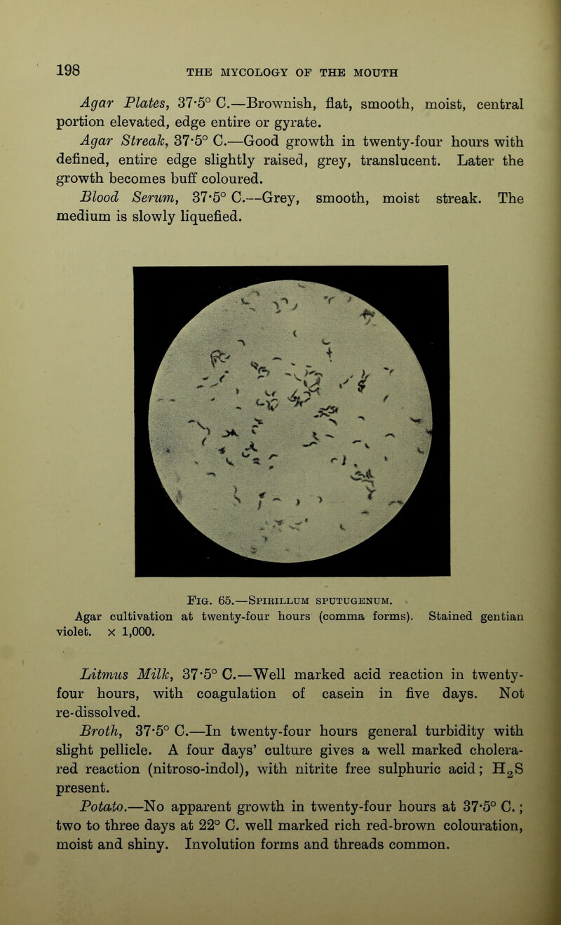 Agar Plates, 37-5° C.—Brownish, flat, smooth, moist, central portion elevated, edge entire or gyrate. Agar Streak, 37'5° C.—Good growth in twenty-fom- hours with defined, entire edge sUghtly raised, grey, translucent. Later the growth becomes buff coloured. Blood Serum, 37*5° C.—Grey, smooth, moist streak. The medium is slowly liquefied. Fig. 65.—Spirillum sputugenum. Agar cultivation at twenty-four hours (comma forms). Stained gentian violet. X 1,000. Litmus Milk, 37*5° C.—Well marked acid reaction in twenty- four hours, with coagulation of casein in five days. Not re-dissolved. Broth, 37*5° C.—In twenty-four hours general turbidity with slight pellicle. A four days' culture gives a well marked cholera- red reaction (nitroso-indol), with nitrite free sulphuric acid; HgS present. Potato.—No apparent growth in twenty-four hours at 37*5° C.; two to three days at 22° C. well marked rich red-brown colouration, moist and shiny. Involution forms and threads common.