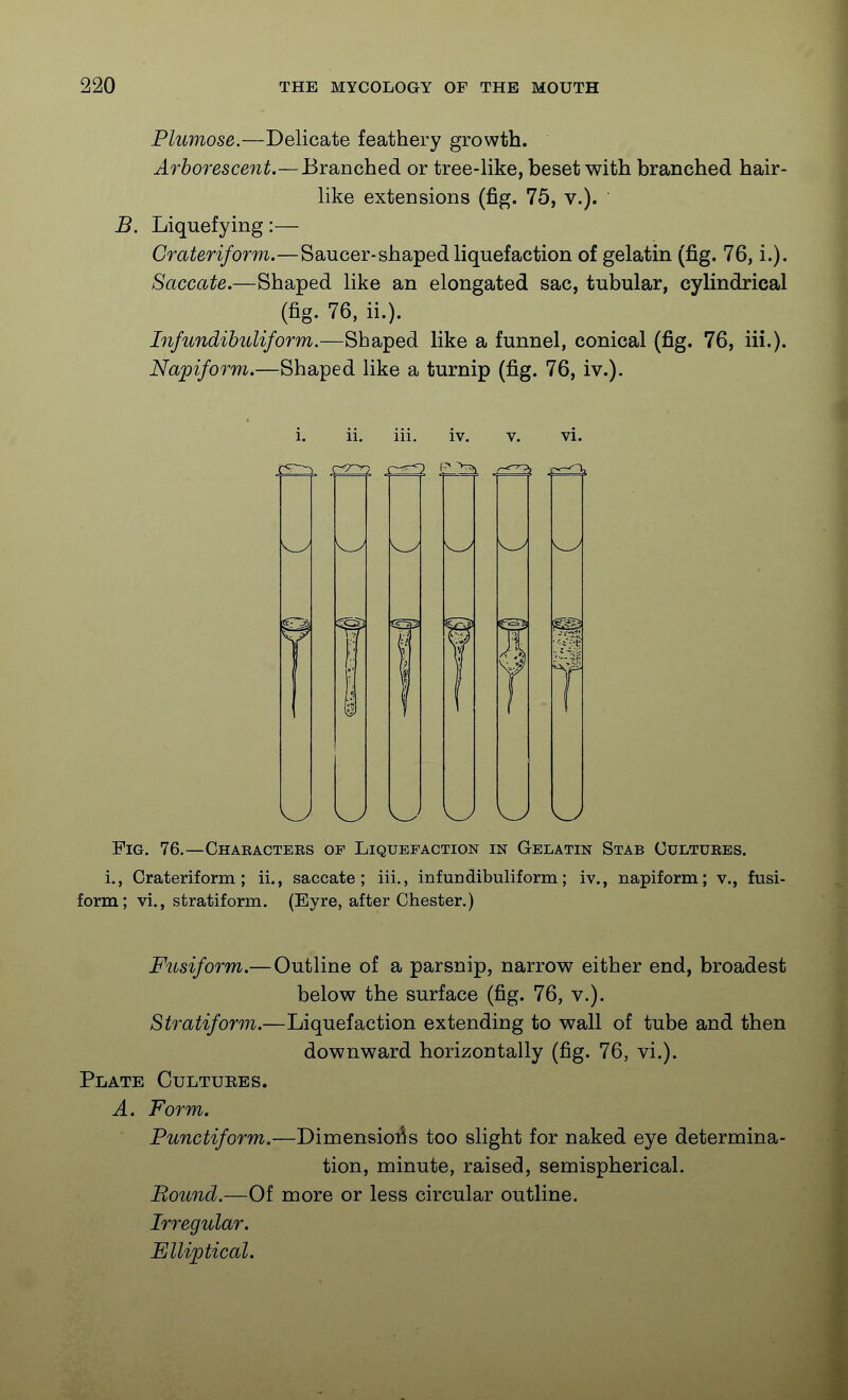 Plumose.—Delicate feathery growth. Arborescent.—Branched or tree-like, beset with branched hair- like extensions (fig. 75, v.). B. Liquefying:— Crateriform.—Saucer-shaped liquefaction of gelatin (fig. 76, i.). Saccate.—Shaped like an elongated sac, tubular, cylindrical (fig. 76, ii.). Infundihuliform.—Shaped like a funnel, conical (fig. 76, iii.). Napiform.—Shaped like a turnip (fig. 76, iv.). i. ii. iii. iv. v. vi. ! ! T Fig. 76.—Chaeactees of Liquefaction in Gelatin Stab Cultuees. i., Crateriform; ii., saccate; iii., infundibuliform; iv., napiform; v., fusi- form; vi., stratiform. (Eyre, after Chester.) Fusiform.—Outline of a parsnip, narrow either end, broadest below the surface (fig. 76, v.). Stratiform.—Liquefaction extending to wall of tube and then downward horizontally (fig. 76, vi.). Plate Cultures. A. Form. Punctiform.—Dimensioi^s too slight for naked eye determina- tion, minute, raised, semispherical. Bound.—Of more or less circular outline. Irregular. Elliptical.