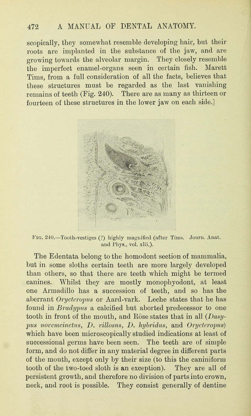 scopically, they somewhat resemble developing hair, but their roots are implanted in the substance of the jaw, and are growing towards the alveolar margin. They closely resemble the imperfect enamel-organs seen in certain fish. Marett Tims, from a full consideration of all the facts, believes that these structures must be regarded as the last vanishing remains of teeth (Fig. 240). There are as many as thirteen or fourteen of these structures in the lower jaw on each side.] Fig. 240.—Tooth-vestiges (?) highly magnified (after Tims. Journ. Anat. and Phys., vol. xlii.). The Edentata belong to the homodont section of mammalia, but in some sloths certain teeth are more largely developed than others, so that there are teeth which might be termed canines. Whilst they are mostly monophyodont, at least one Armadillo has a succession of teeth, and so has the aberrant Orycteropus or Aard-vark. Leche states that he has found in Brady pus a calcined but aborted predecessor to one tooth in front of the mouth, and Kose states that in all (Dasy- pus novemcinctus, D. villosus, D. hybridus, and Orycteropus) which have been microscopically studied indications at least of successional germs have been seen. The teeth are of simple form, and do not differ in any material degree in different parts of the mouth, except only by their size (to this the caniniform tooth of the two-toed sloth is an exception). They are all of persistent growth, and therefore no division of parts into crown, neck, and root is possible. They consist generally of dentine