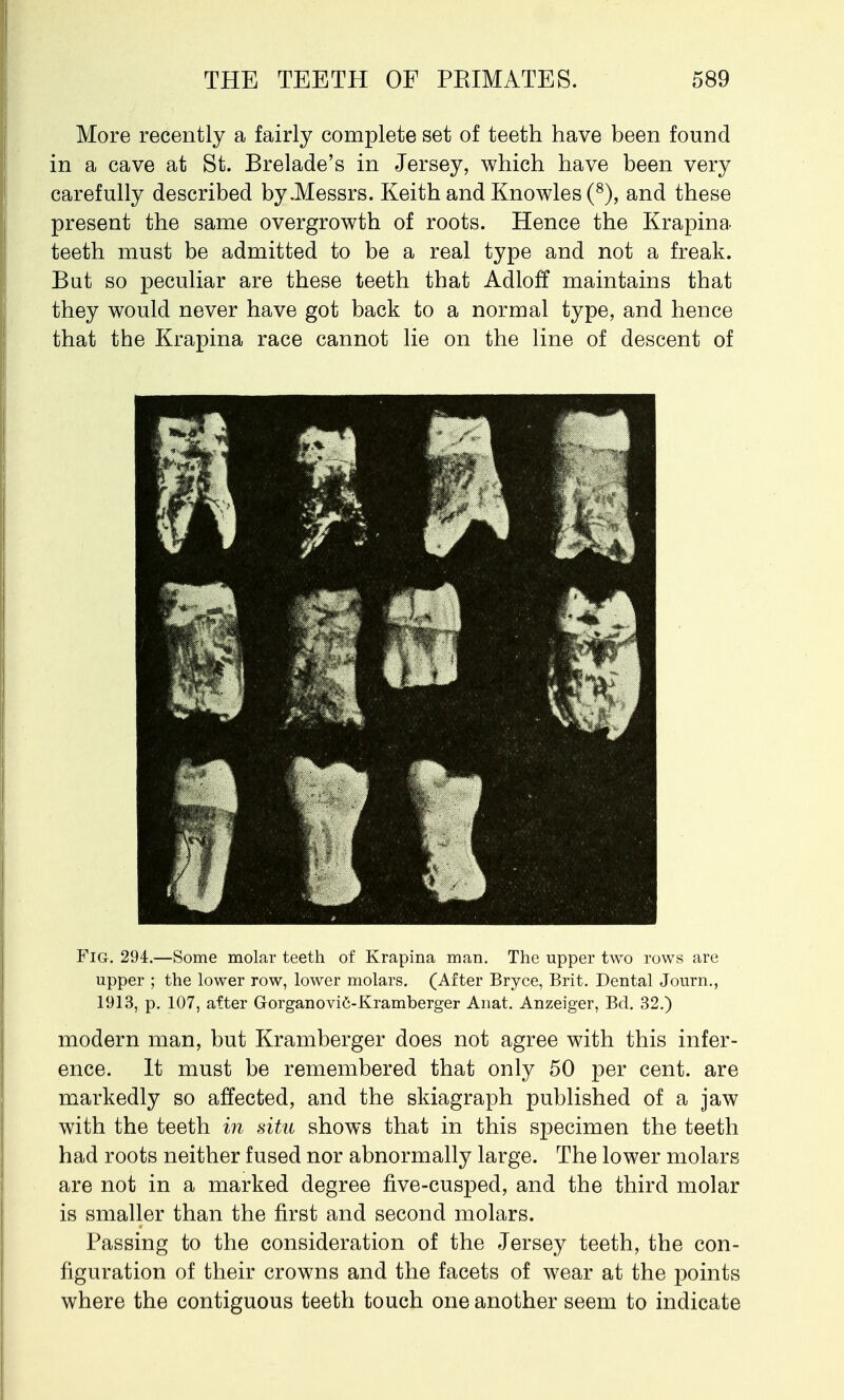 More recently a fairly complete set of teeth have been found in a cave at St. Brelade's in Jersey, which have been very carefully described by .Messrs. Keith and Knowles (8), and these present the same overgrowth of roots. Hence the Krapina teeth must be admitted to be a real type and not a freak. But so peculiar are these teeth that Adloff maintains that they would never have got back to a normal type, and hence that the Krapina race cannot lie on the line of descent of Fig. 294.—Some molar teeth of Krapina man. The upper two rows are upper ; the lower row, lower molars. (After Bryce, Brit. Dental Journ., 1913, p. 107, after Gorganovic-Kramberger Anat. Anzeiger, Bd. 32.) modern man, but Kramberger does not agree with this infer- ence. It must be remembered that only 50 per cent, are markedly so affected, and the skiagraph published of a jaw with the teeth in situ shows that in this specimen the teeth had roots neither fused nor abnormally large. The lower molars are not in a marked degree five-cusped, and the third molar is smaller than the first and second molars. Passing to the consideration of the Jersey teeth, the con- figuration of their crowns and the facets of wear at the points where the contiguous teeth touch one another seem to indicate