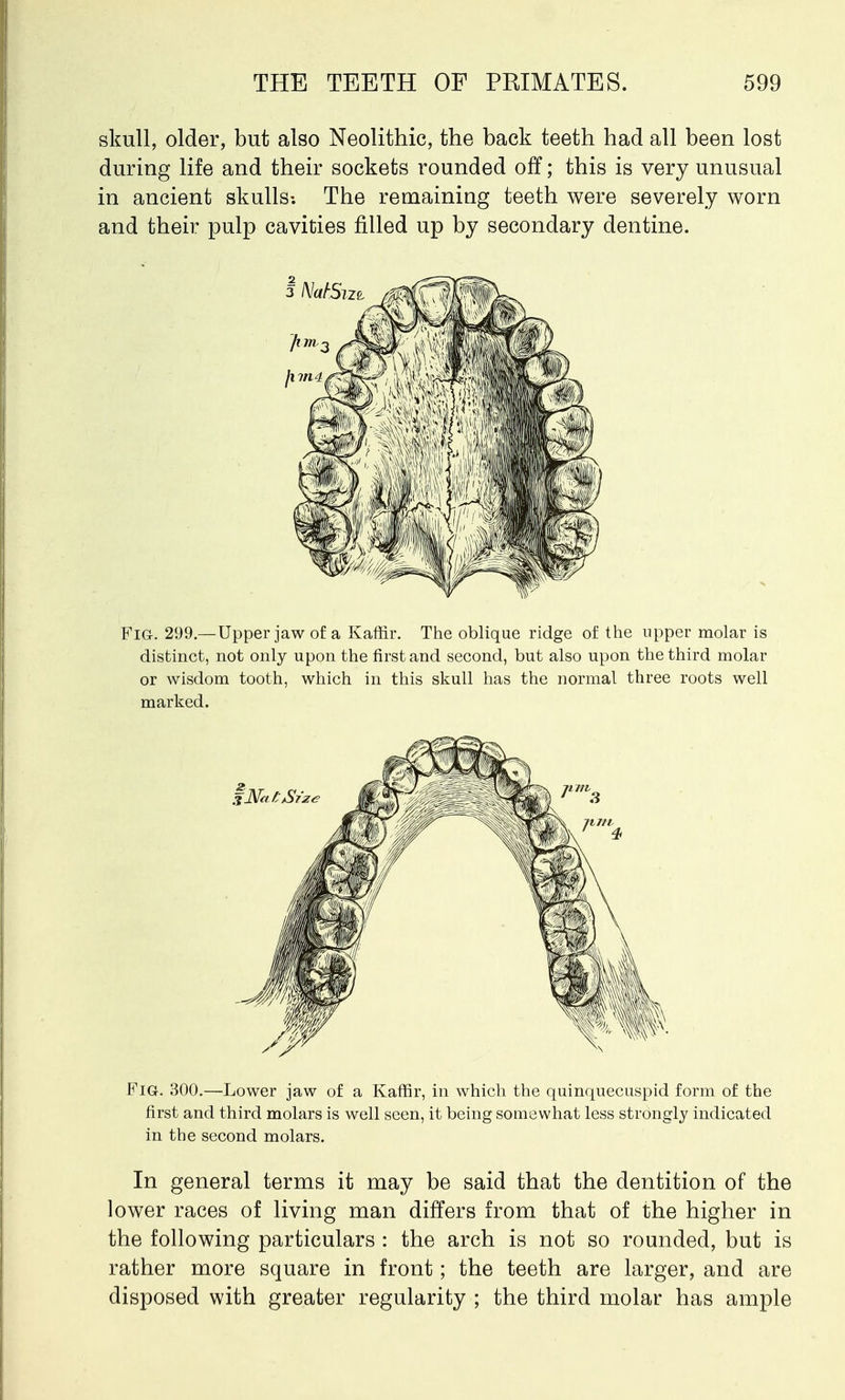 skull, older, but also Neolithic, the back teeth had all been lost during life and their sockets rounded off; this is very unusual in ancient skulls-. The remaining teeth were severely worn and their pulp cavities filled up by secondary dentine. Fig. 299.— Upper jaw of a Kaffir. The oblique ridge of the upper molar is distinct, not only upon the first and second, but also upon the third molar or wisdom tooth, which in this skull has the normal three roots well marked. Fig. 300.—Lower jaw of a Kaffir, in which the quinquecuspid form of the first and third molars is well seen, it being somewhat less strongly indicated in the second molars. In general terms it may be said that the dentition of the lower races of living man differs from that of the higher in the following particulars : the arch is not so rounded, but is rather more square in front; the teeth are larger, and are disposed with greater regularity ; the third molar has ample